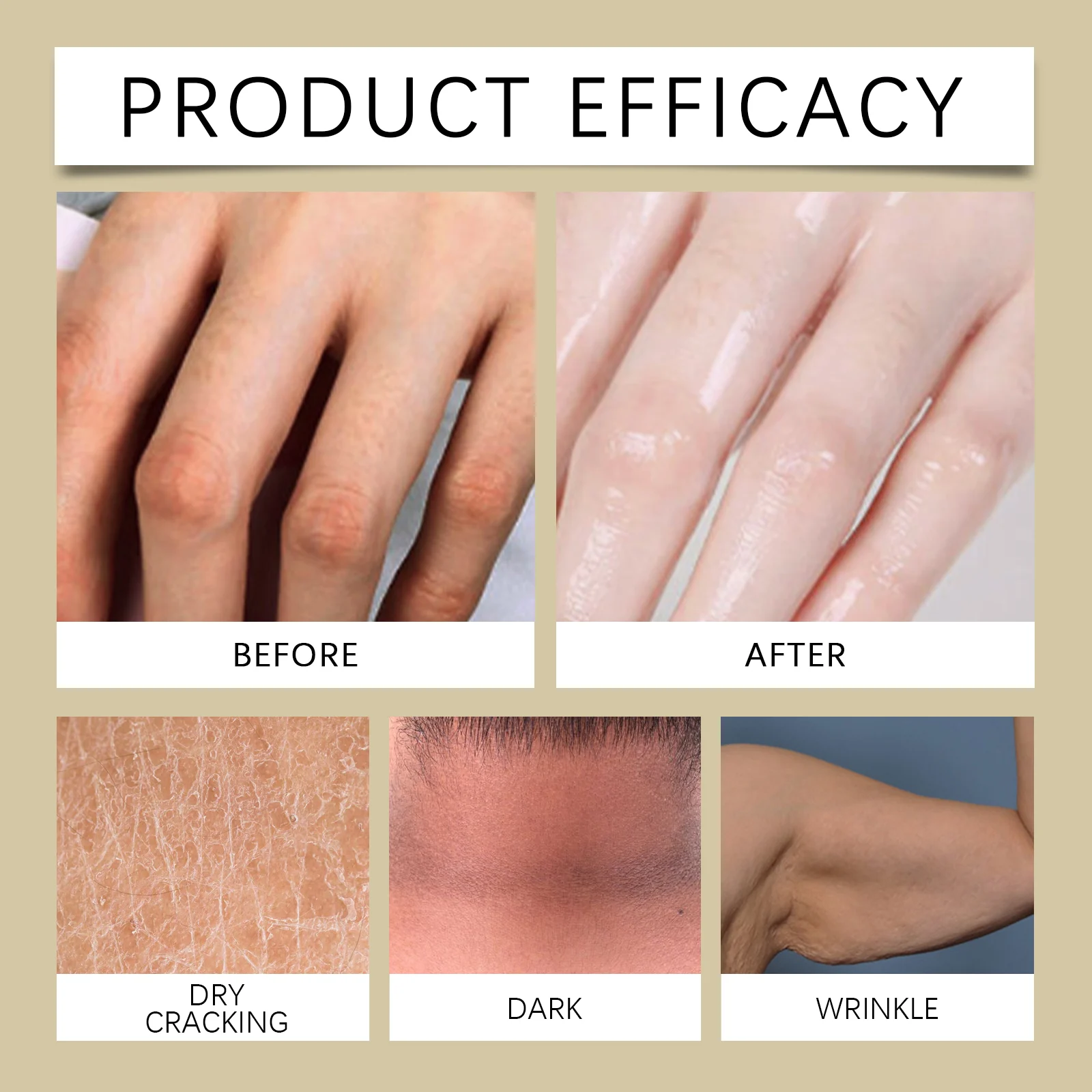 Acanthosis Nigricans Body Serum with Niacinamide & Vitamin C - 30ml Moisturizing Brightening Treatment 9 acanthosis nigricans body serum 30ml wes cyaqe6pk desc 9
