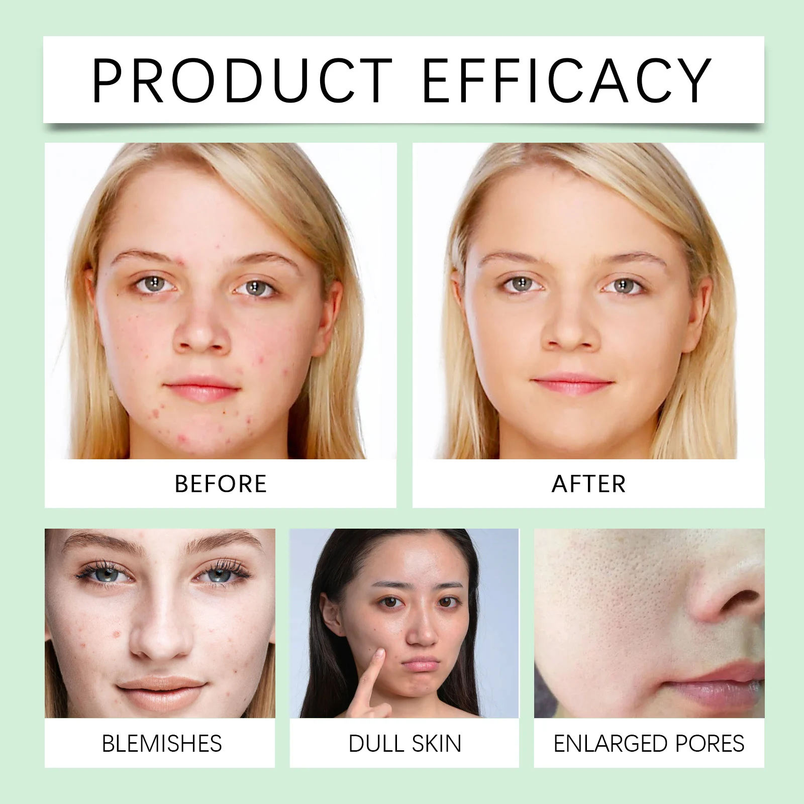 Acne-Fighting Facial Cleanser Gentle Deep Pore Cleanse Oil Control Non-Drying 100g 12 acne fighting facial cleanser oil control 100g wes zdyz3xhe desc 12