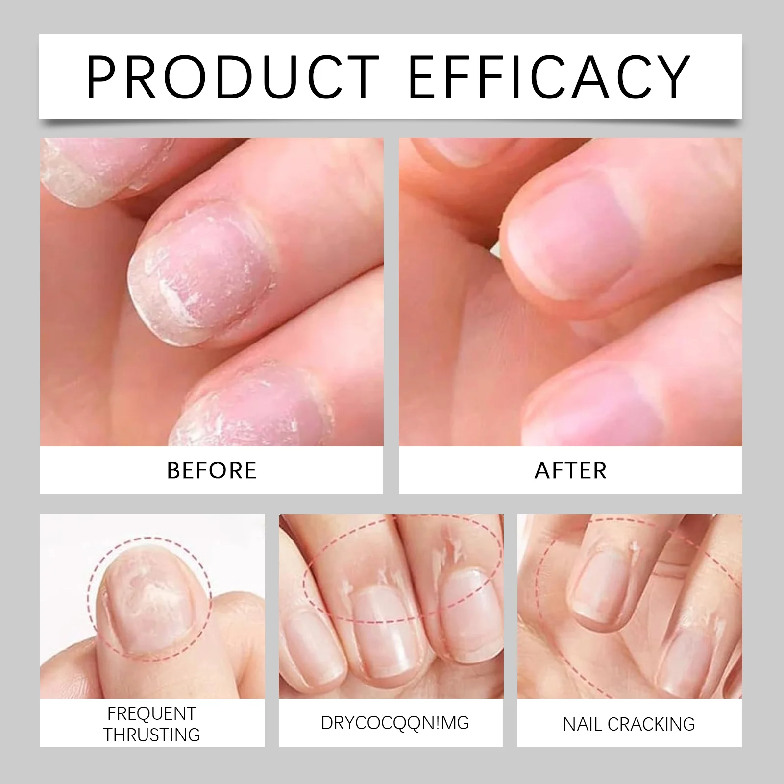Cuticle Oil Aloe Vera Nail Care Oil for Strengthening and Moisturizing Nails 9 aloe vera cuticle oil nail care oil 3ml wes 29uufnza desc 9