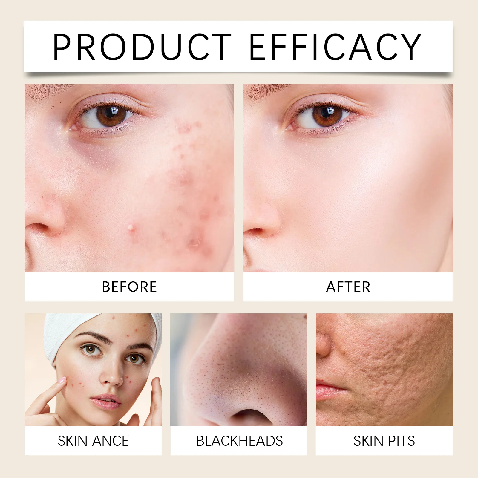 Amino Acid Facial Cleanser 100g Gentle Cleansing Improves Skin Condition 9 amino acid facial cleanser 100g wes 57hupur5 desc 9