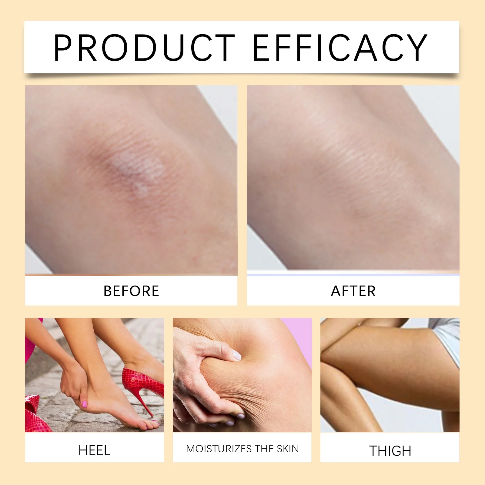 West Month Anti-Chafe Balm Skin Repair Stick for Body, Friction Protection & Moisturizing 9 anti chafe balm skin repair stick wes xmhyezky desc 9