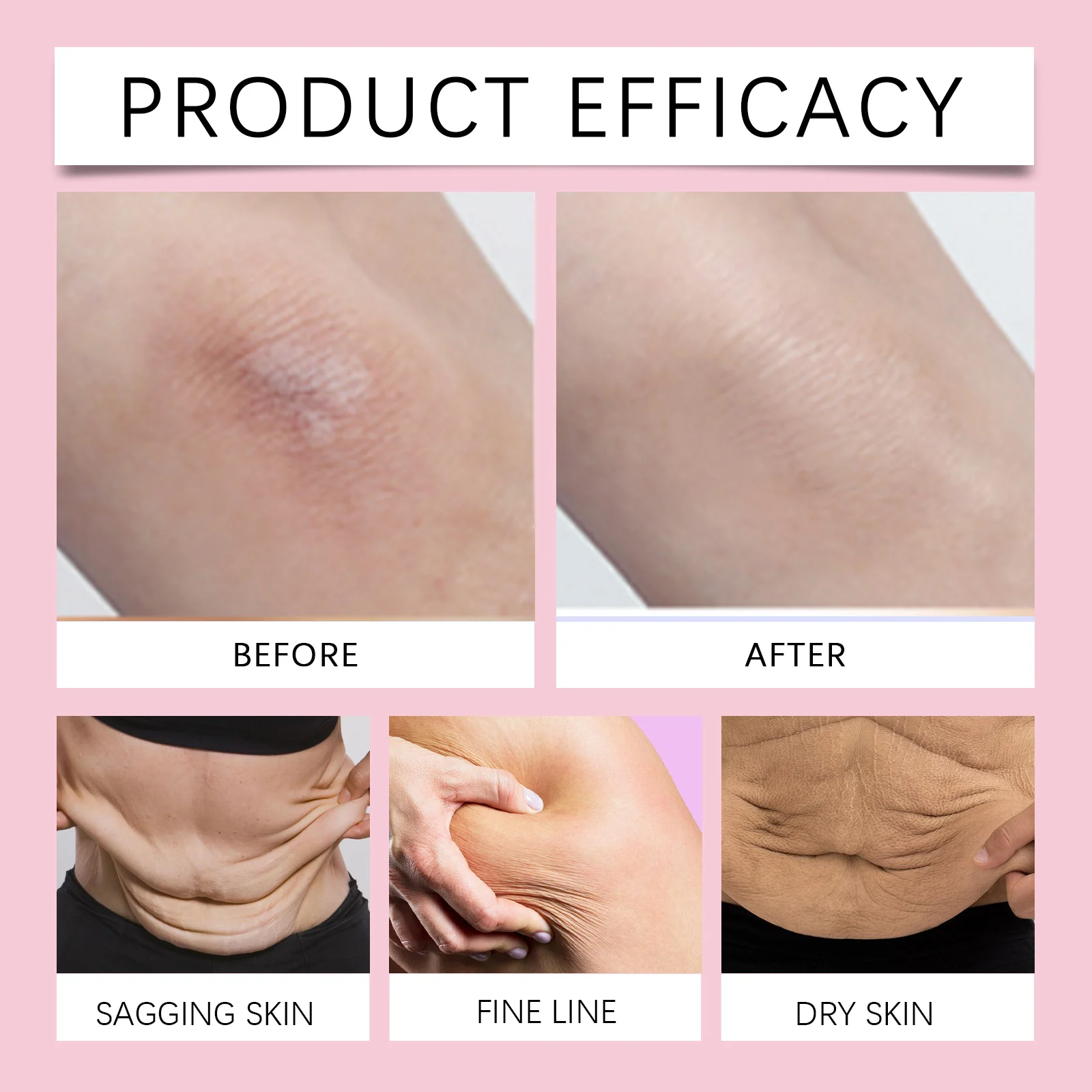 Anti Chafing Stick for Skin Friction and Dryness Relief with Shea Butter and Vitamin E 40g 9 anti chafing stick shea butter vitamin e 40g wes 4sz67j2r desc 9