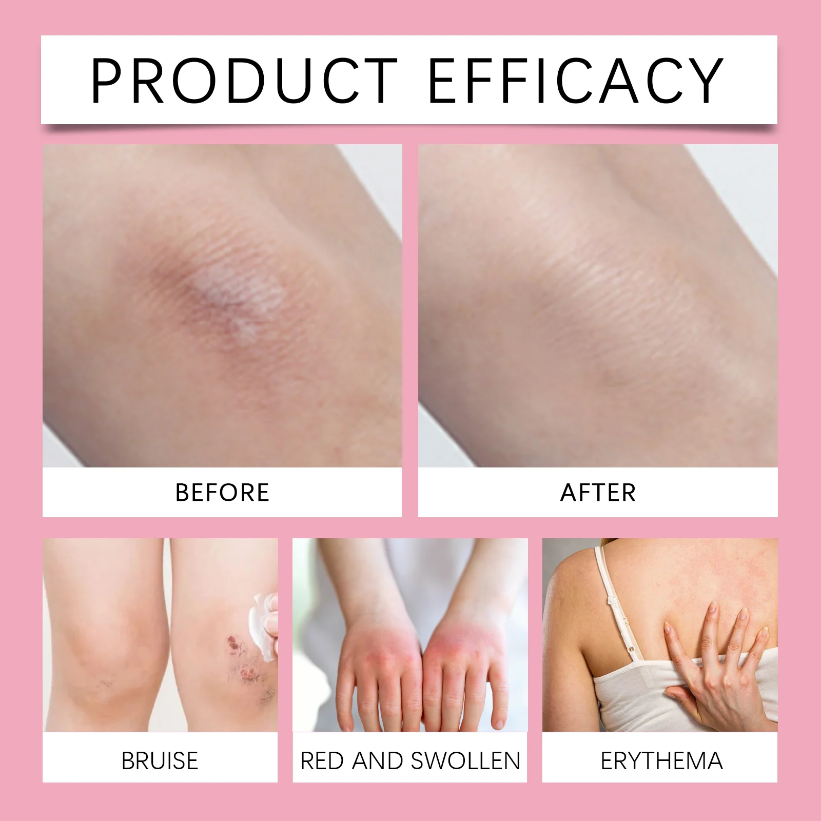Anti-Friction Body Cream Stick 40g for Skin Protection and Moisturizing 9 anti friction body cream stick 40g wes rhf4evbm desc 9