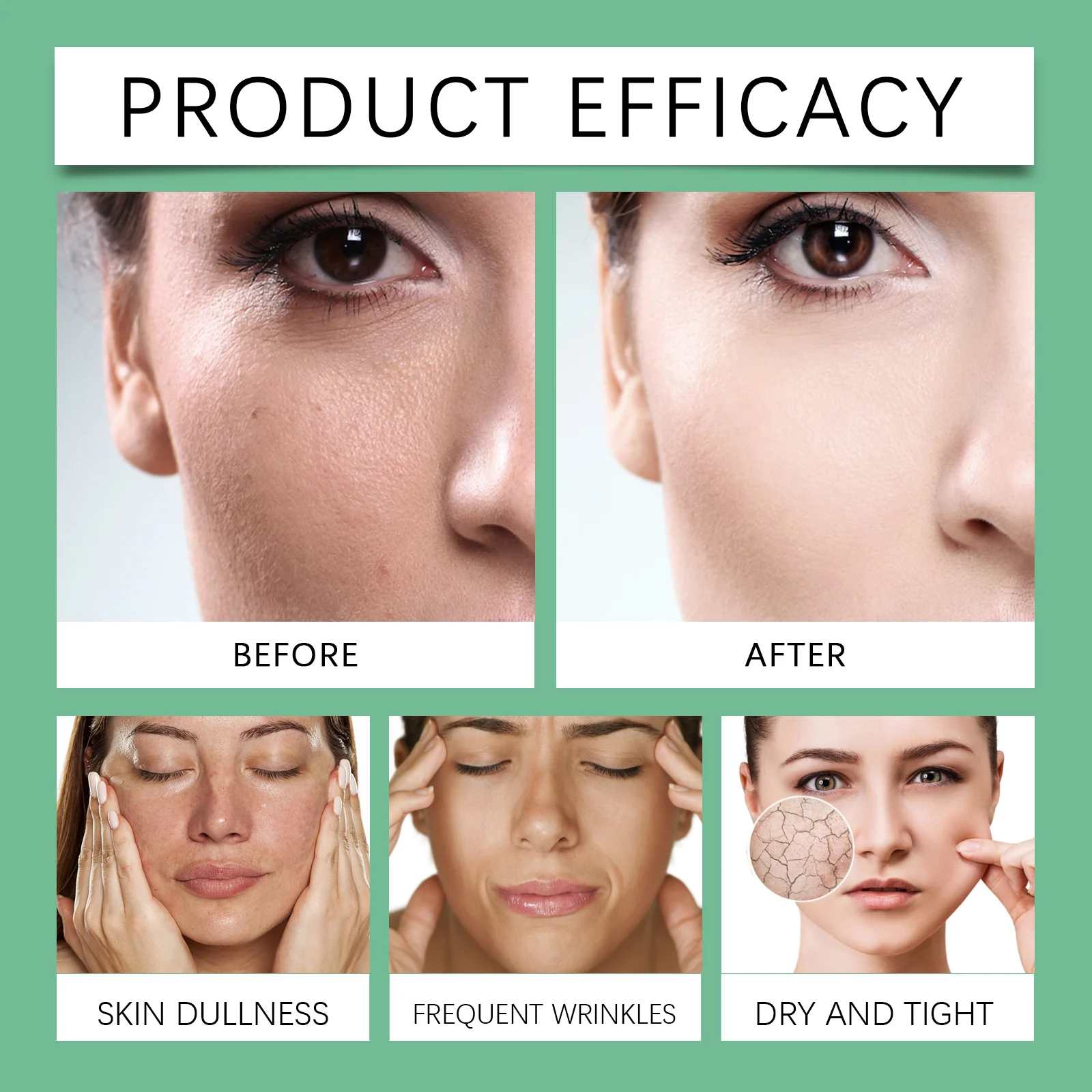 Azelaic Acid Cream 30g for Oily Skin with Vitamin C, Niacinamide for Skin Brightening & Hydration 9 azelaic acid cream 30g oil control brightening wes p3des3na desc 9