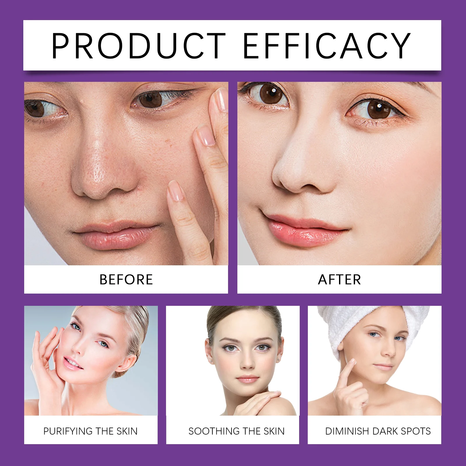 Azelaic Acid Repair Cream 12% with Niacinamide & Vitamin C, Soothing Acne Treatment, 20g 8 azelaic acid repair cream 12 percent niacinamide vitamin c 20g wes x26wev2r desc 8