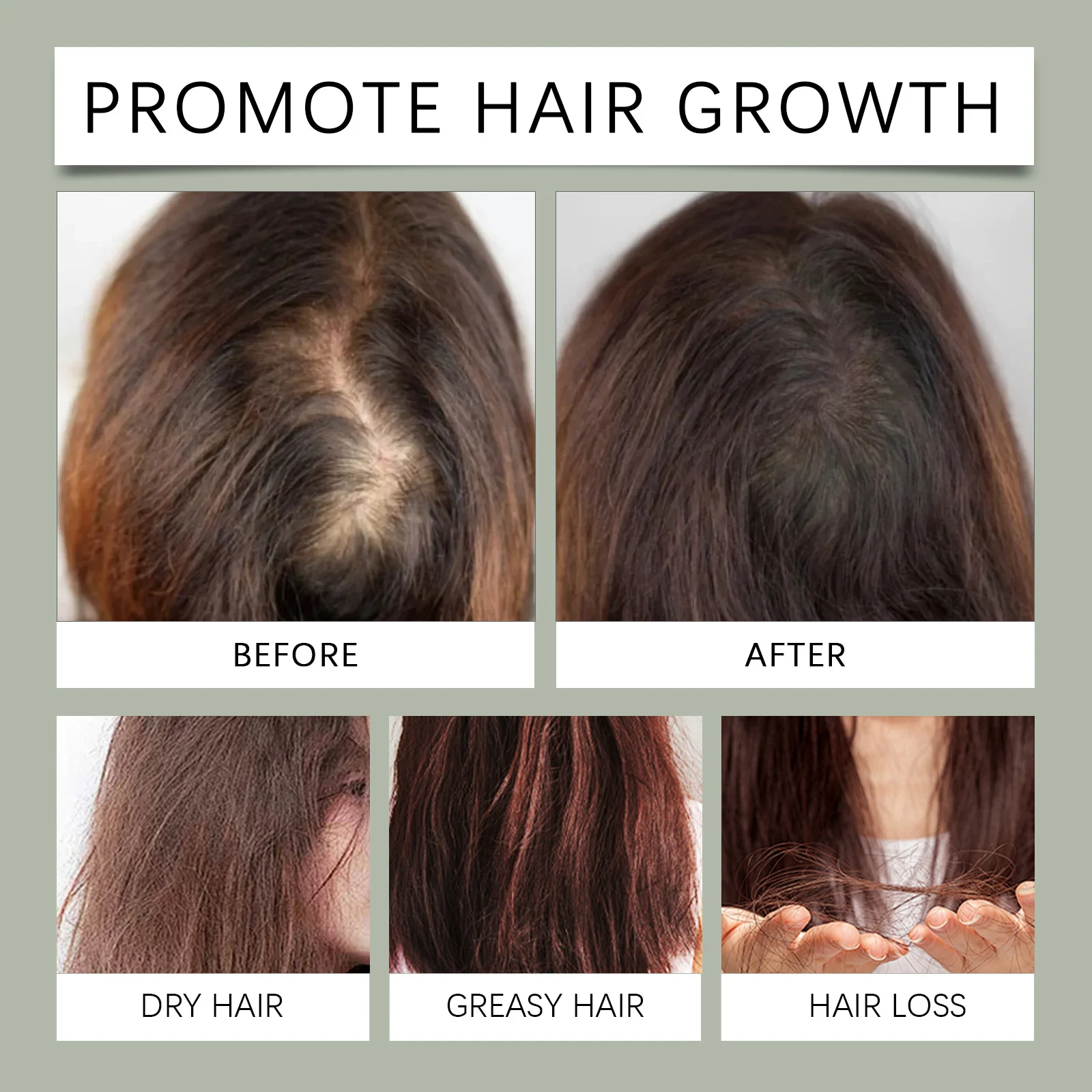 West Month Batana Hair Growth Oil - Nourishes, Strengthens & Adds Luster 9 batana hair growth oil wes 6bzmb2bn desc 9
