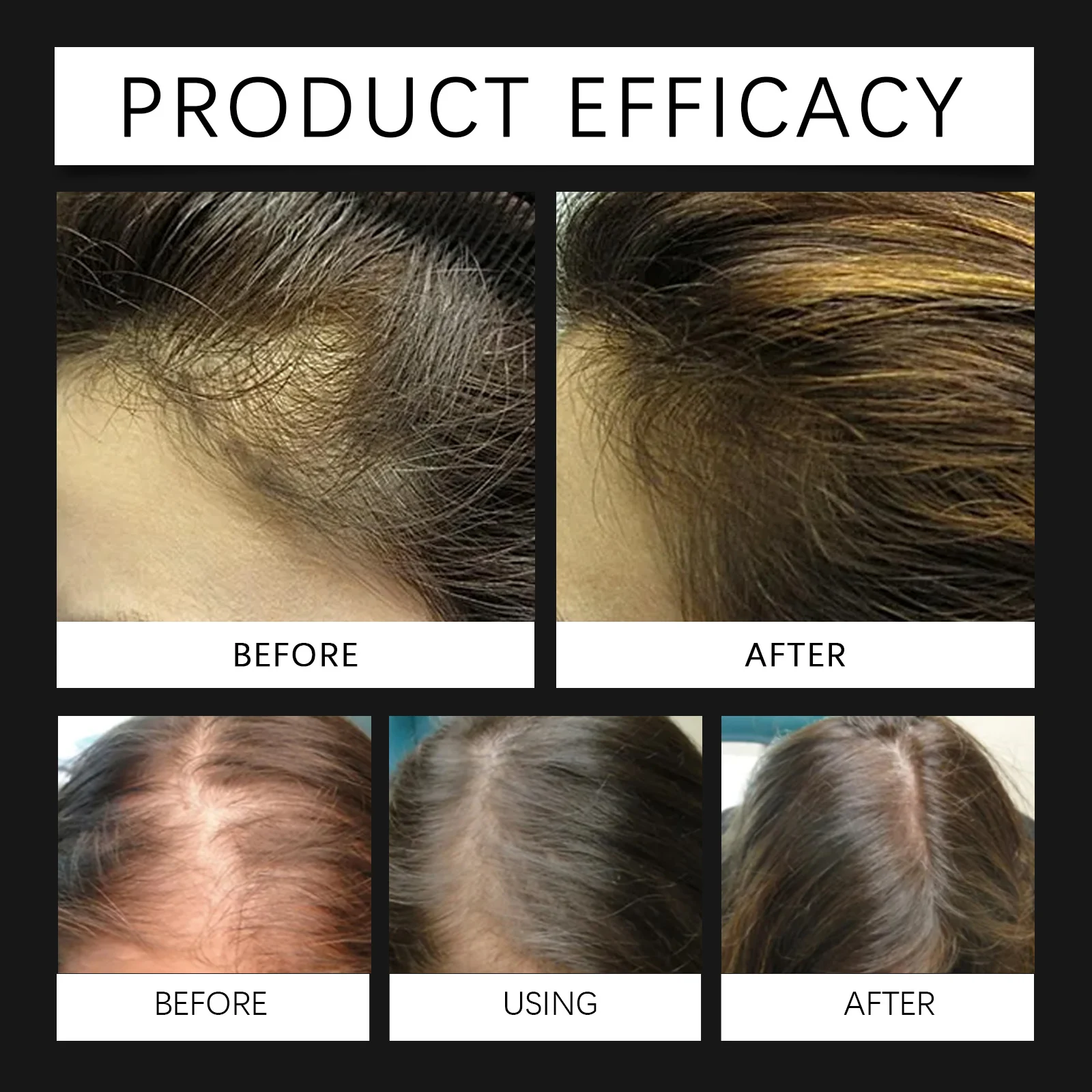 West Month Batana Hair Oil for Hair Growth, Dense Fuller & Healthier Hair 9 batana hair growth oil wes fzghjxr6 desc 9