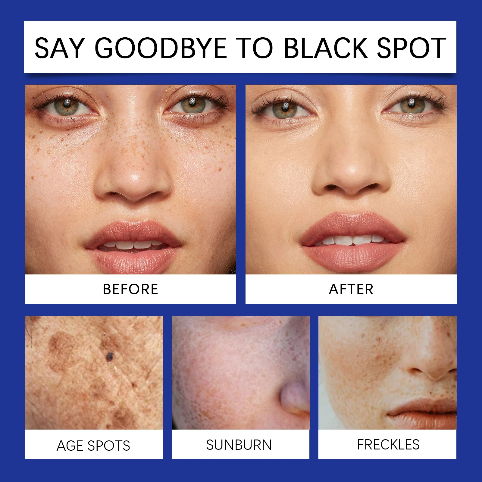 Bee Venom Body Care Cream 50g for Deep Moisturizing & Pigmentation Correction 9 bee venom body care cream 50g wes qfu3urdc desc 9