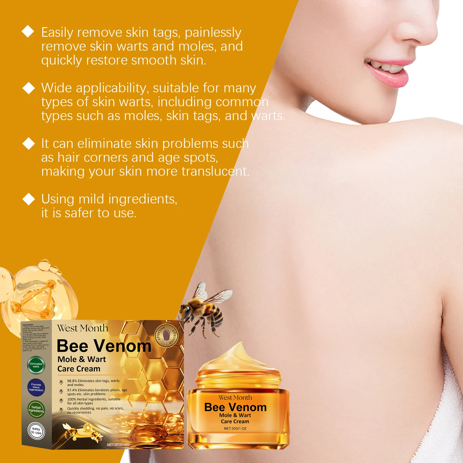 Bee Venom Mole & Wart Removal Cream 30g for Smooth Skin & Painless Treatment 5 bee venom mole wart removal cream 30g wes 4u6xyjcx desc 5