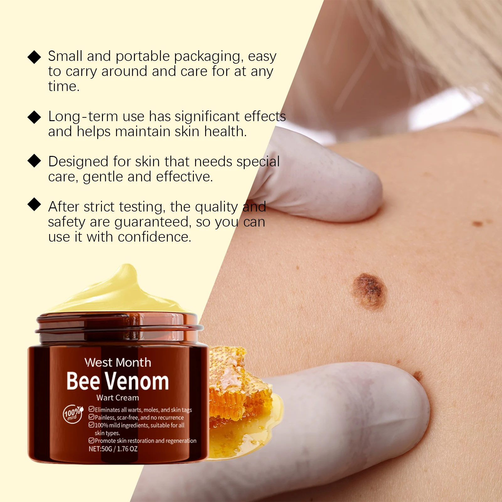 Bee Venom Wart Removal Cream Skin Tag Mole Remover Treatment 50g 8 bee venom wart removal cream skin tag mole remover treatment 50g wes ekdm2cvw desc 8