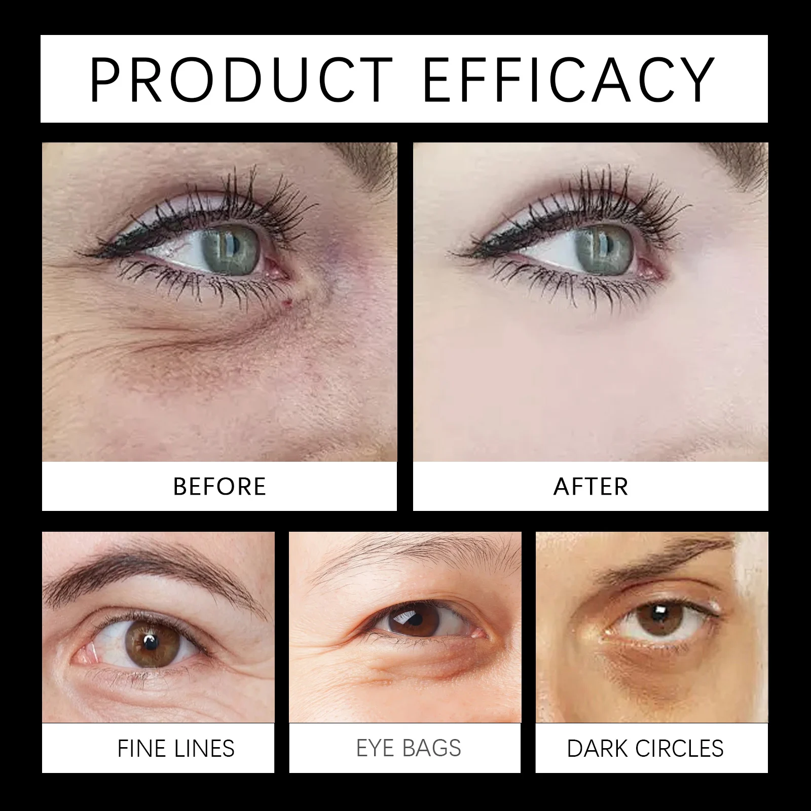 West Month Brightening Eye Cream - Moisturizing & Anti-Dark Circles with Vitamin C & Chlorella 9 brightening eye cream wes ntjvjfmv desc 9