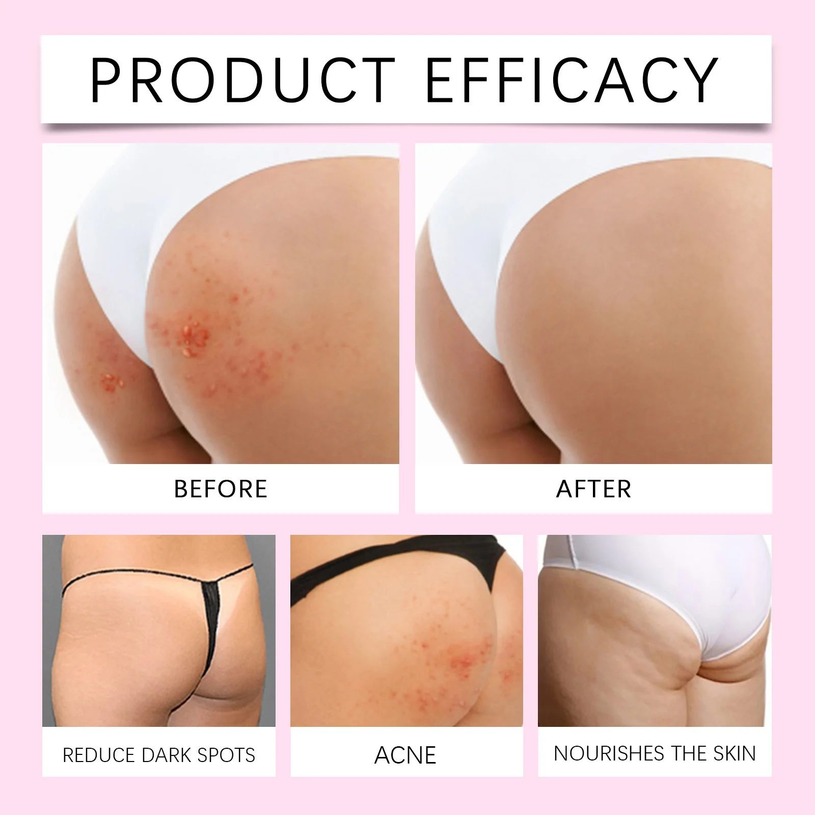 West Month Buttocks Acne Care Shower Gel - Fade Acne & Dark Spots, Gentle Cleansing 9 buttocks acne care shower gel wes er7p2xxa desc 9