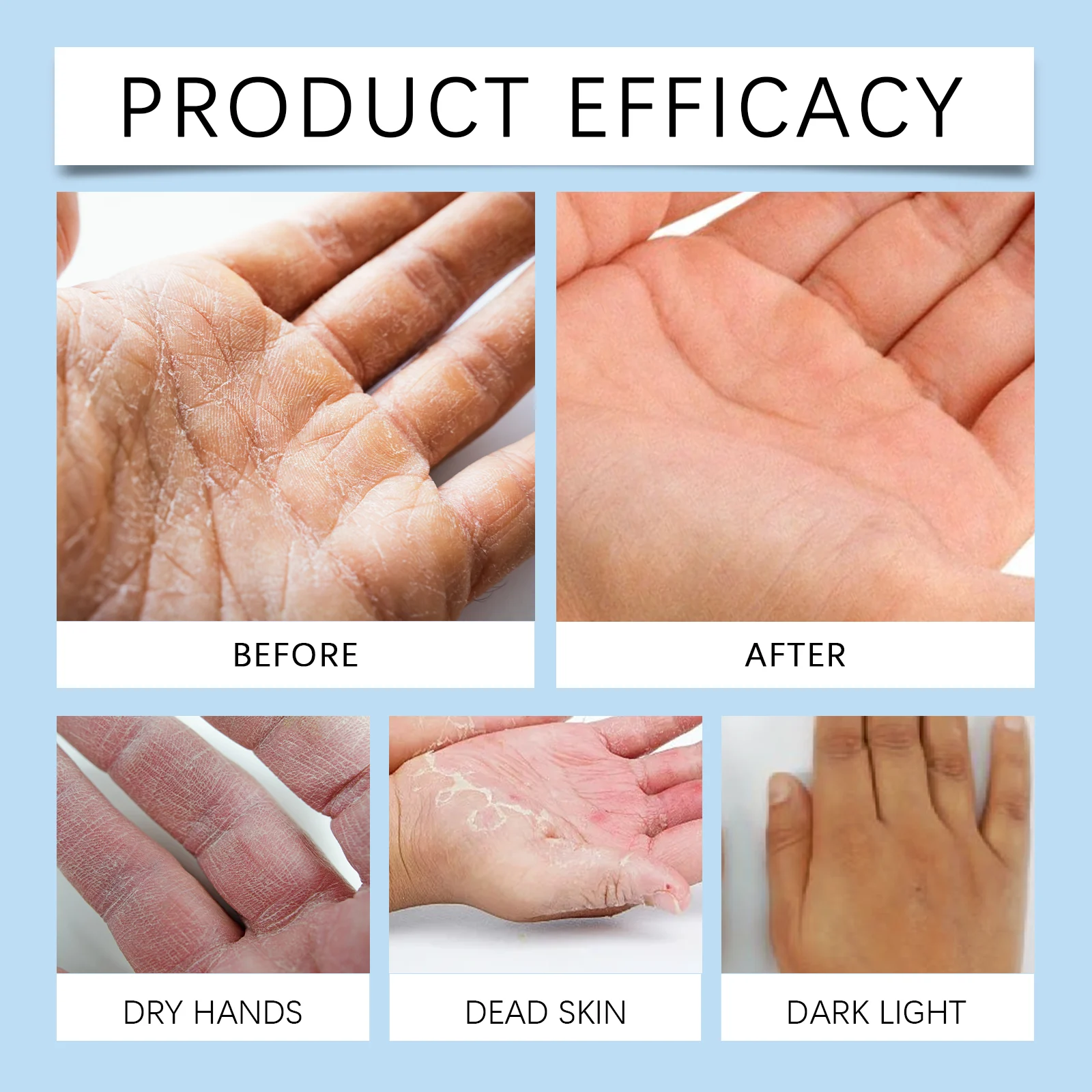 Dryness Relief Hand Cream 60g for Eczema, Cracked Skin & Moisturization 9 dryness relief hand cream 60g wes tf543r2d desc 9