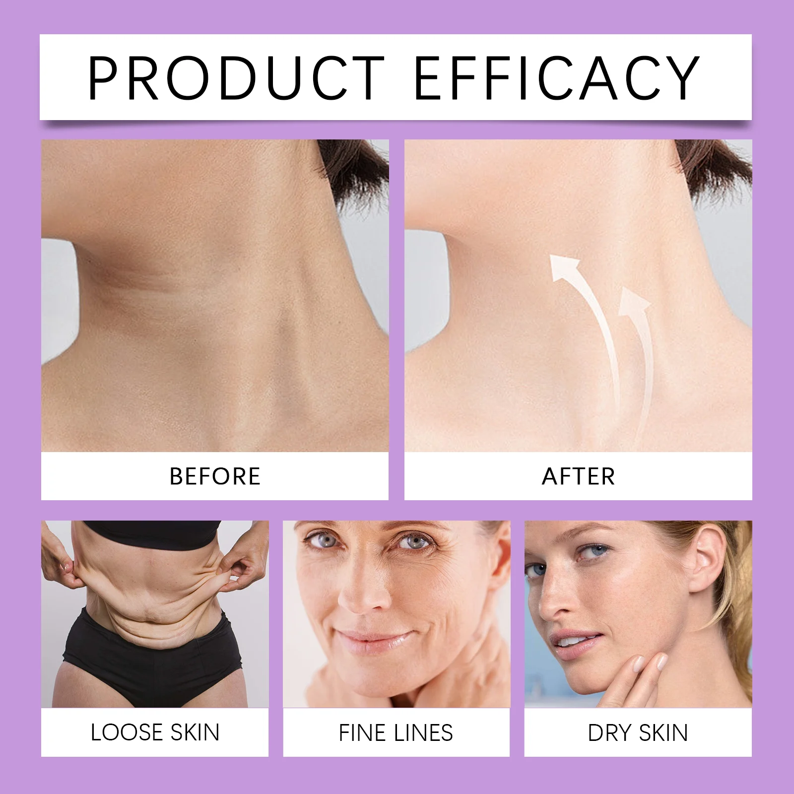 Exfoliating Gel for Body 100g, Gentle Dead Skin Remover with Brightening & Hydration 9 exfoliating gel body dead skin remover brightening 100g wes rbtcqvwk desc 9