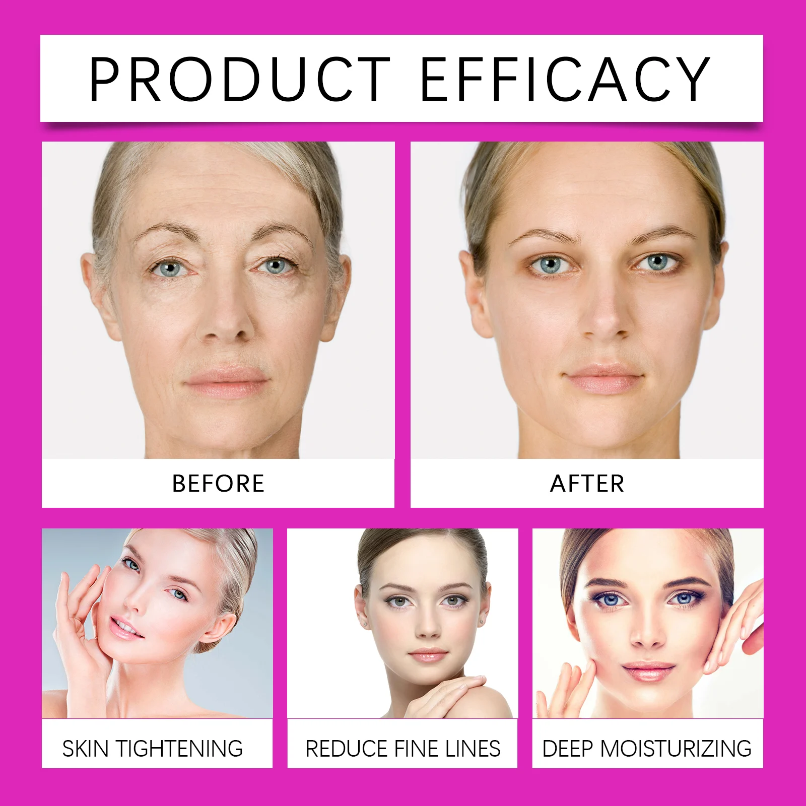West Month Face Smoothing Wrinkle Patches - 192 Patches for Forehead, Eyes, Chin 9 face wrinkle smoothing patches wes k2w5vs39 desc 9