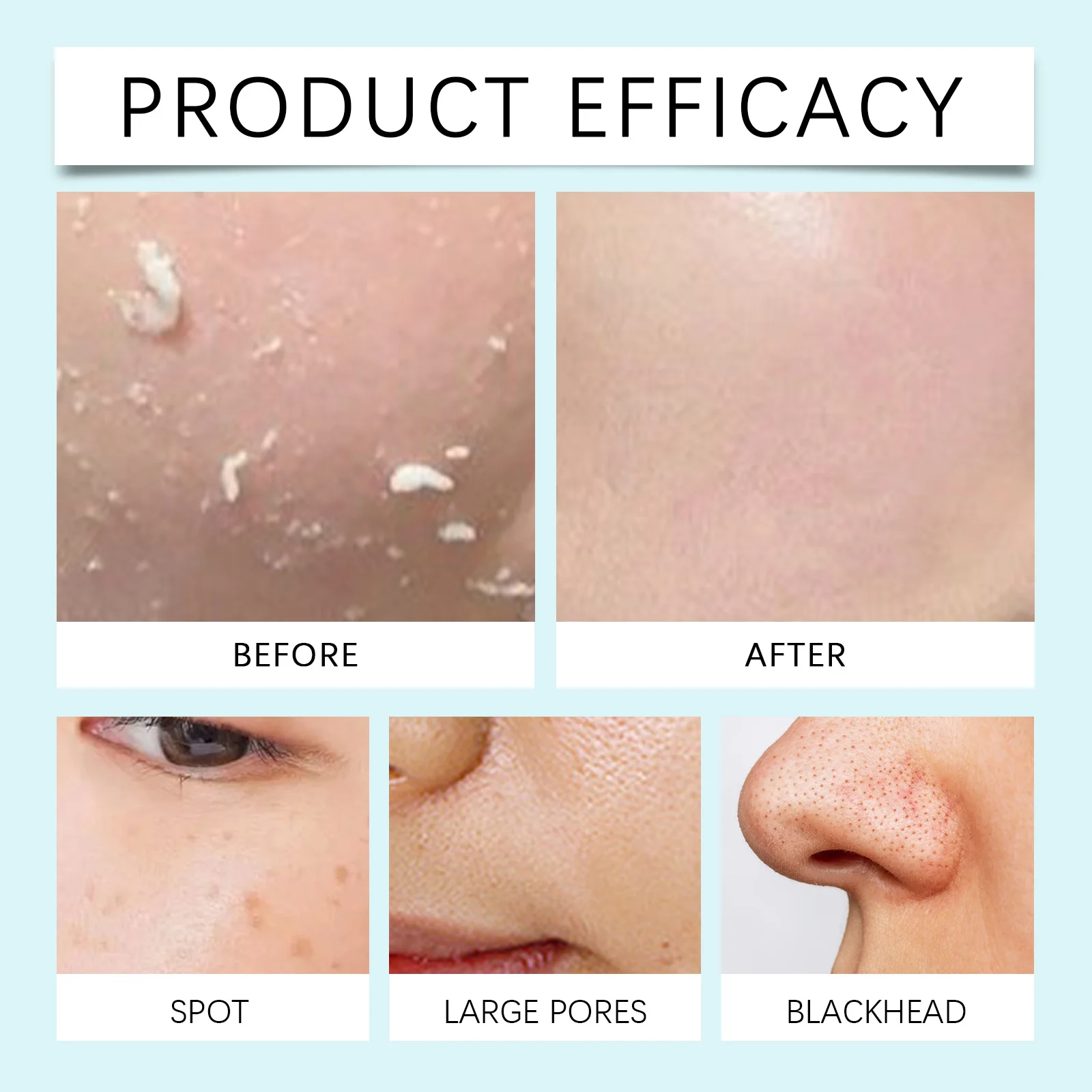 Facial Exfoliant Serum Gentle Exfoliating Liquid for Smooth Skin 100ml 9 facial exfoliant serum gentle exfoliating liquid 100ml wes ba62x4v8 desc 9