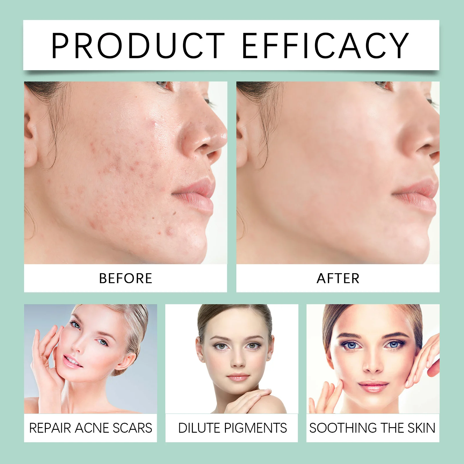 Facial Toner for Acne and Closed Comedones Gentle Triple-Action Formula 100ml 8 facial toner acne closed comedones 100ml wes rgcg2hzv desc 8