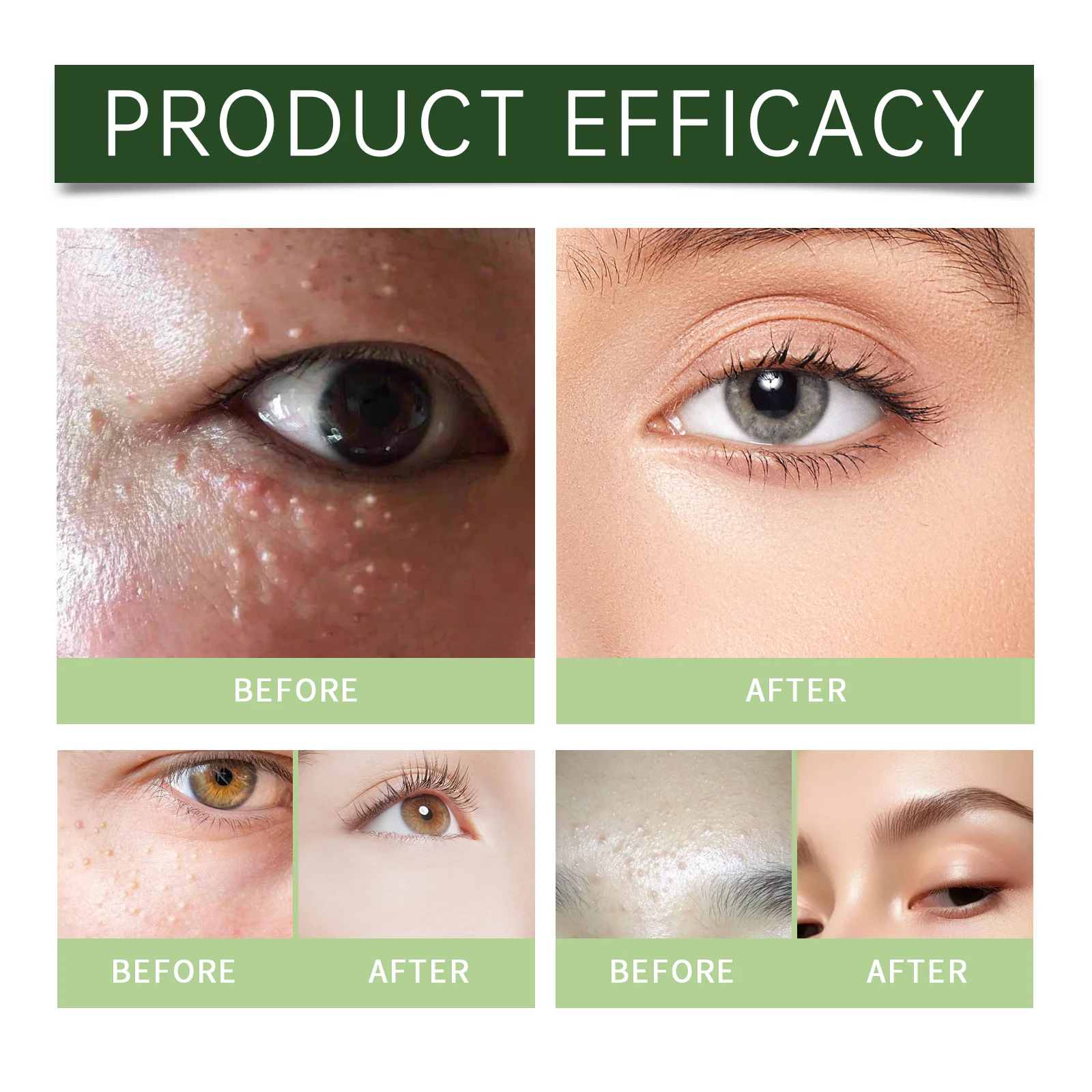 Fat Particle Repair Skin Cream | Soothing Moisturizer for Smooth & Healthy Skin 20g 9 fat particle repair skin cream 20g wes rapp62g3 desc 9