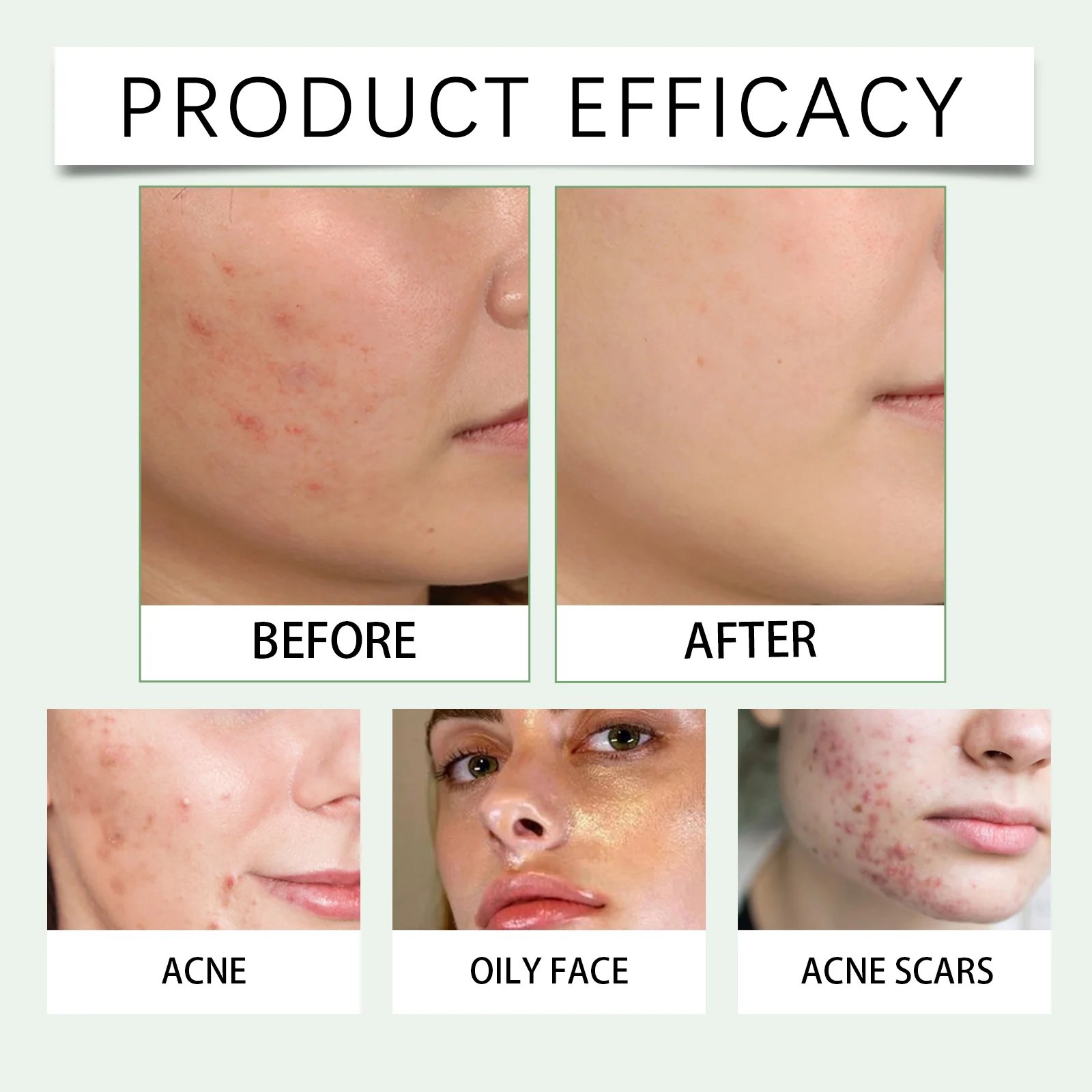 Gentle Facial Exfoliating Scrub 100g with Tea Tree Oil & Lactic Acid for Smooth & Radiant Skin 12 gentle facial exfoliating scrub 100g tea tree oil lactic acid wes qmdtpxfz desc 12