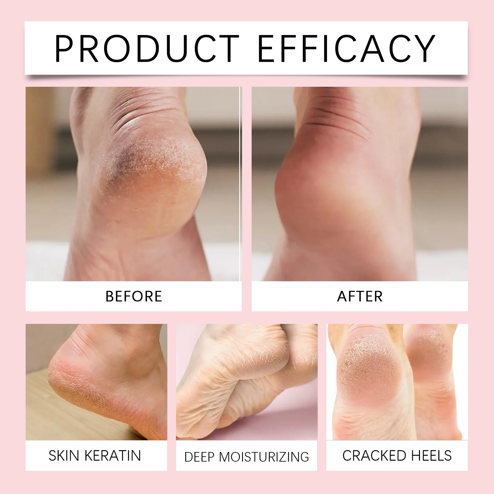 West Month Heel Repair Balm for Cracked Dry Feet Moisturizing Foot Care Stick 9 heel repair balm foot care wes ub8fcz7n desc 9