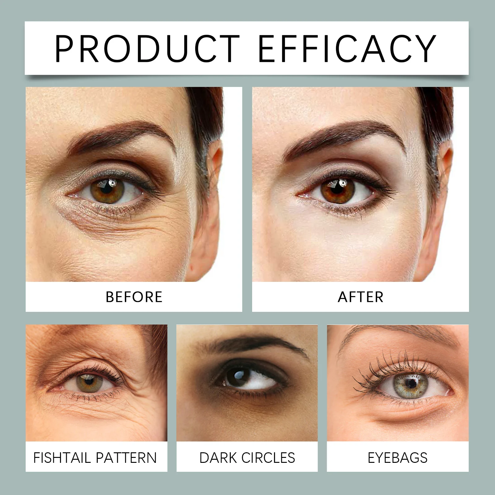 Hyaluronic Acid Eye Patches Brighten Skin Tone Moisturize Hydrate Reduce Fine Lines Crow's Feet 9 hyaluronic acid dissolving microneedle eye patches wes veftm9fv desc 9