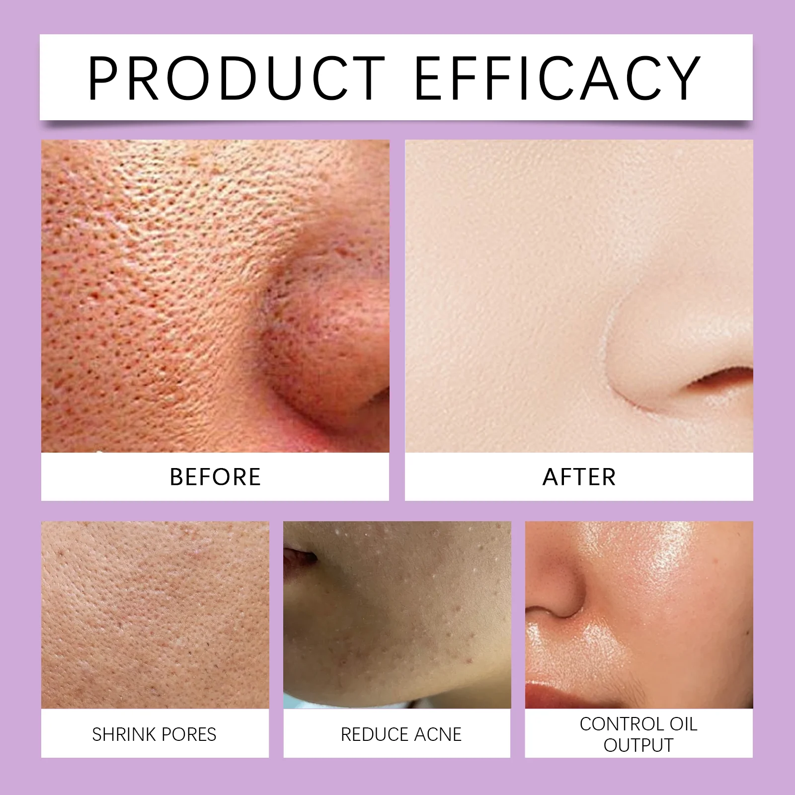 Hydrating Serum with Bakuchiol & Hyaluronic Acid for Pore Minimizing & Skin Firming 30ml 9 hydrating serum bakuchiol hyaluronic acid pore minimizing skin firming 30ml wes 5gw7pkvf desc 9
