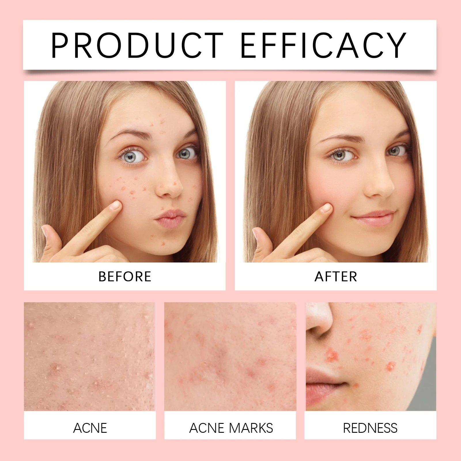 West Month Invisible Acne Patches with Centella Asiatica & Salicylic Acid for Spot Coverage 9 invisible acne patches wes tt9zp8ek desc 9