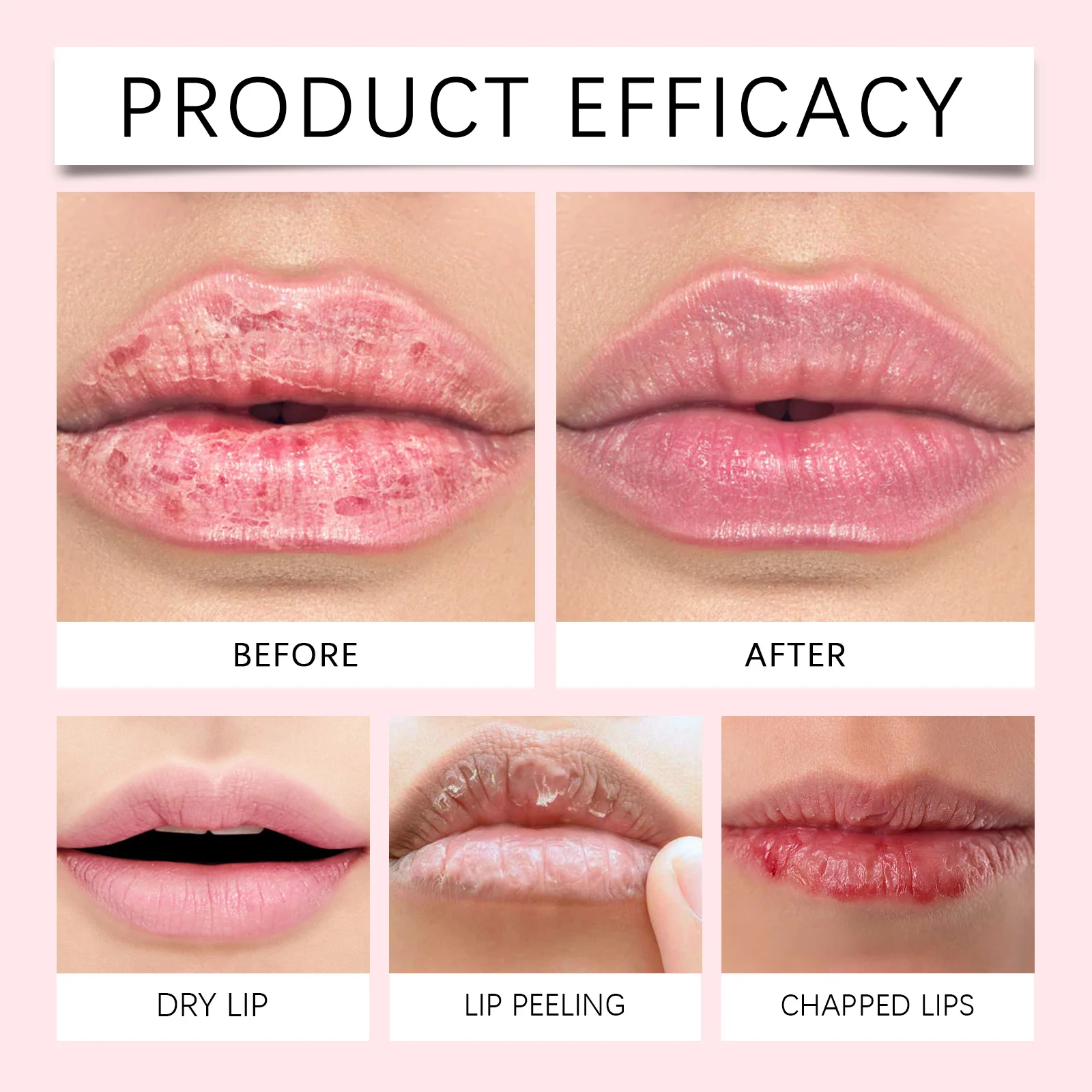 West Month Lip Revitalize Balm - Moisturizing, Soothes Dry & Chapped Lips, Fragrance Free 12 lip balm moisturizer wes mahz7aq8 desc 12