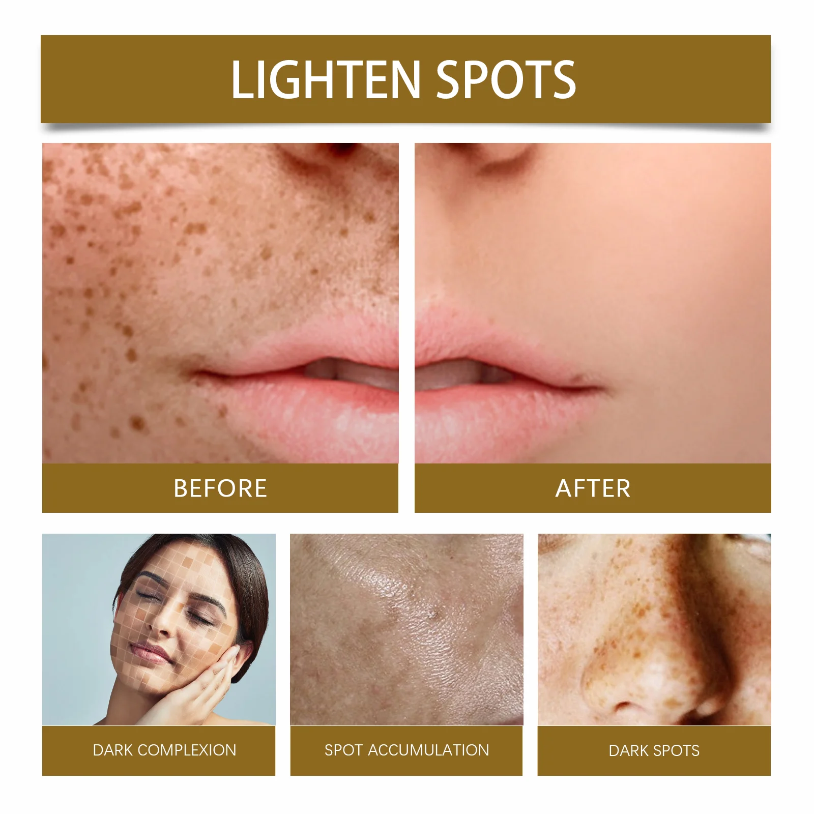 Milia Spot Essential Oil Brighten Skin Reduce Dark Spots Hydrating Facial Treatment 30ml 9 milia spot essential oil brighten skin 30ml wes vw9gzkdx desc 9