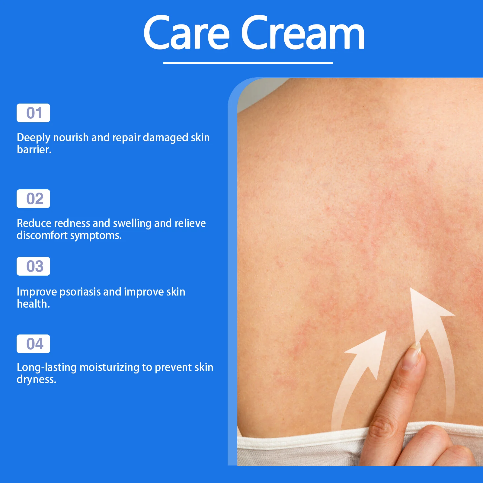 West Month Mild Care Cream - Skin Nourishing & Psoriasis Relief Cream - 100ml 5 moisturizing skin care cream wes 88rg6d8q desc 5