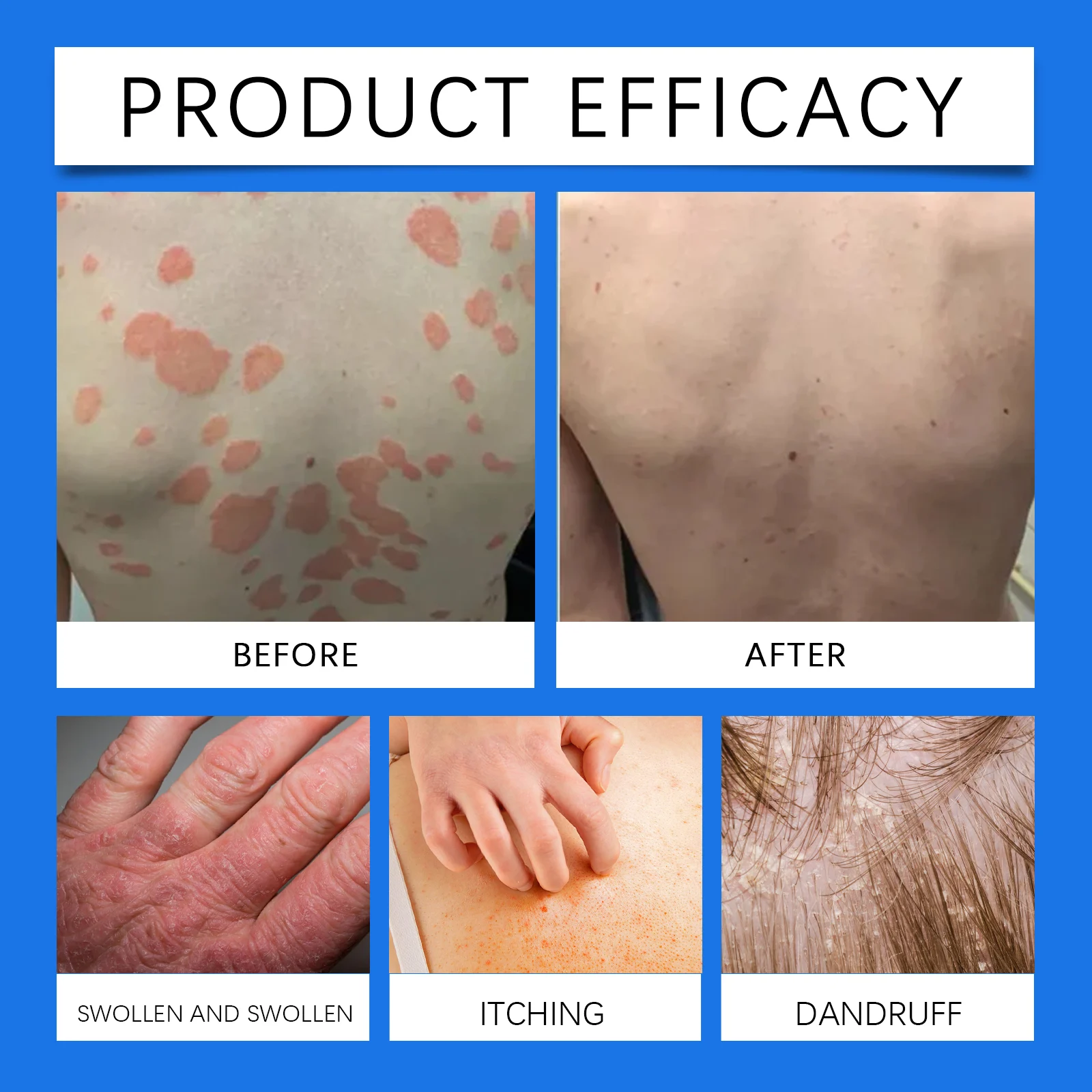West Month Mild Care Cream - Skin Nourishing & Psoriasis Relief Cream - 100ml 9 moisturizing skin care cream wes 88rg6d8q desc 9