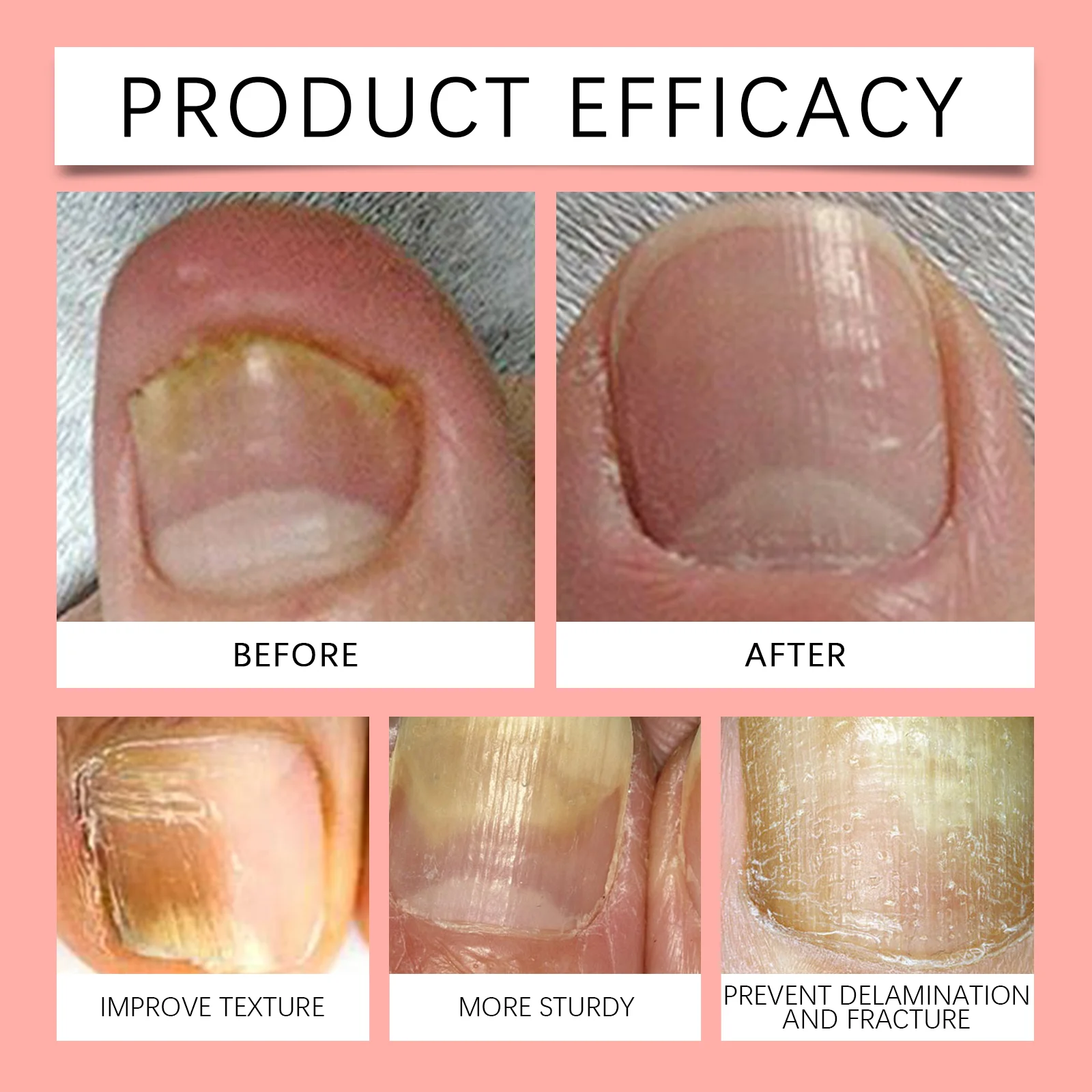 Nail Care Serum 30ml with Keratin & Sophora Flavescens Extract for Strengthening and Growth 9 nail care serum 30ml keratin sophora flavescens wes hjze238k desc 9