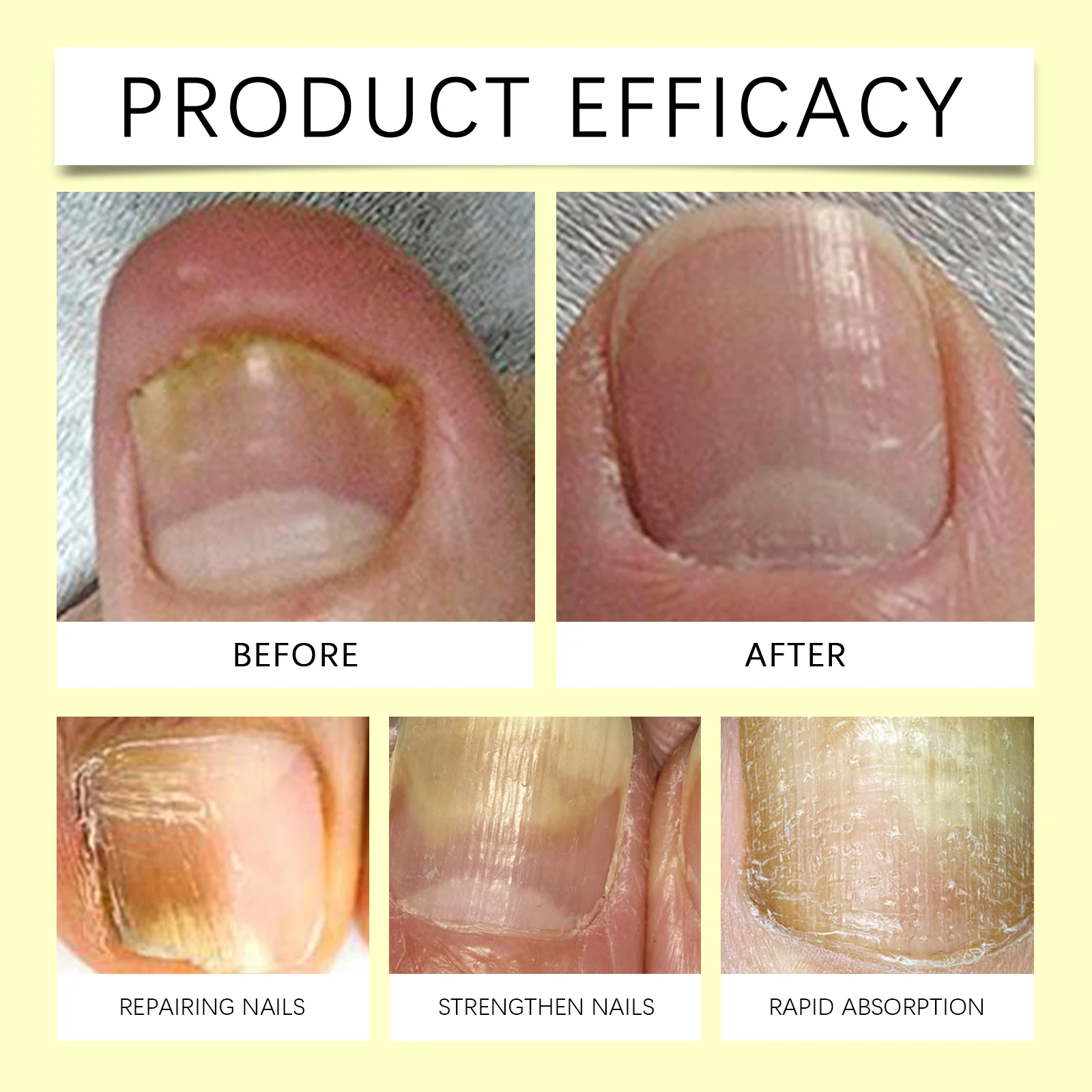Nail Cuticle Oil 15ml for Strengthening, Smoothing & Nail Health Care 10 nail cuticle oil strengthening smoothing care 15ml wes j9zhbq57 desc 10