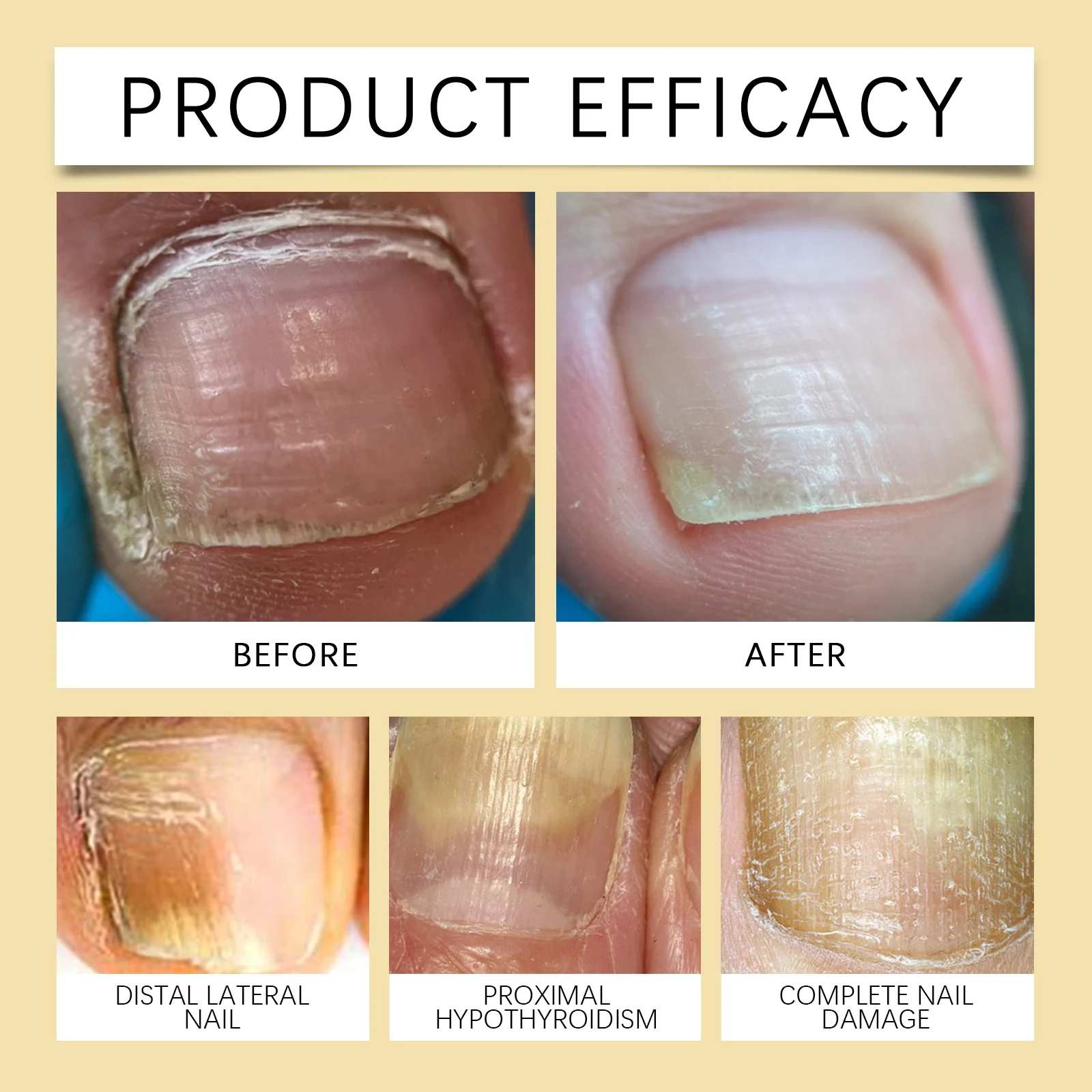Nail Repair Pen Nail Care Cuticle Treatment with Grapeseed Oil & Vitamin E 9 nail repair pen cuticle oil growth treatment wes p28g33wk desc 9