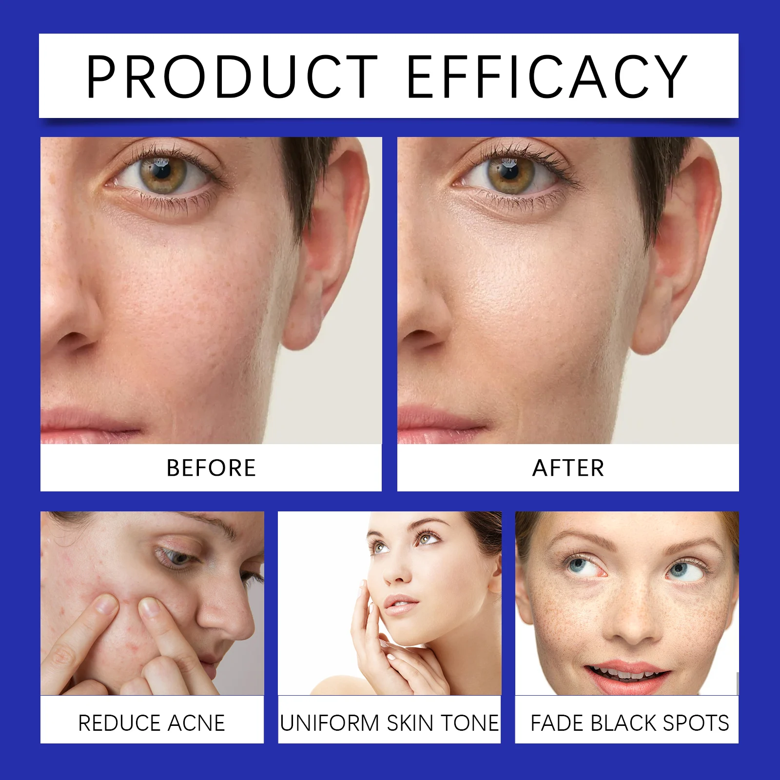 West Month Resurfacing Niacinamide Serum with Encapsulated Retinol & Ceramides 9 niacinamide brightening serum wes ze7s4cyf desc 9