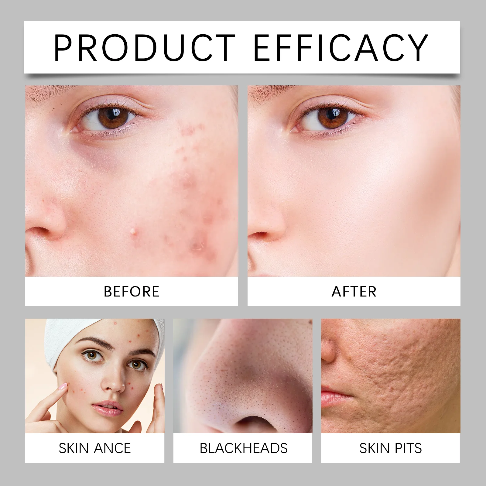 Niacinamide Toner for Brightening and Hydrating Skin 120ml 9 niacinamide milk skin toner 120ml wes j8ee2yw5 desc 9