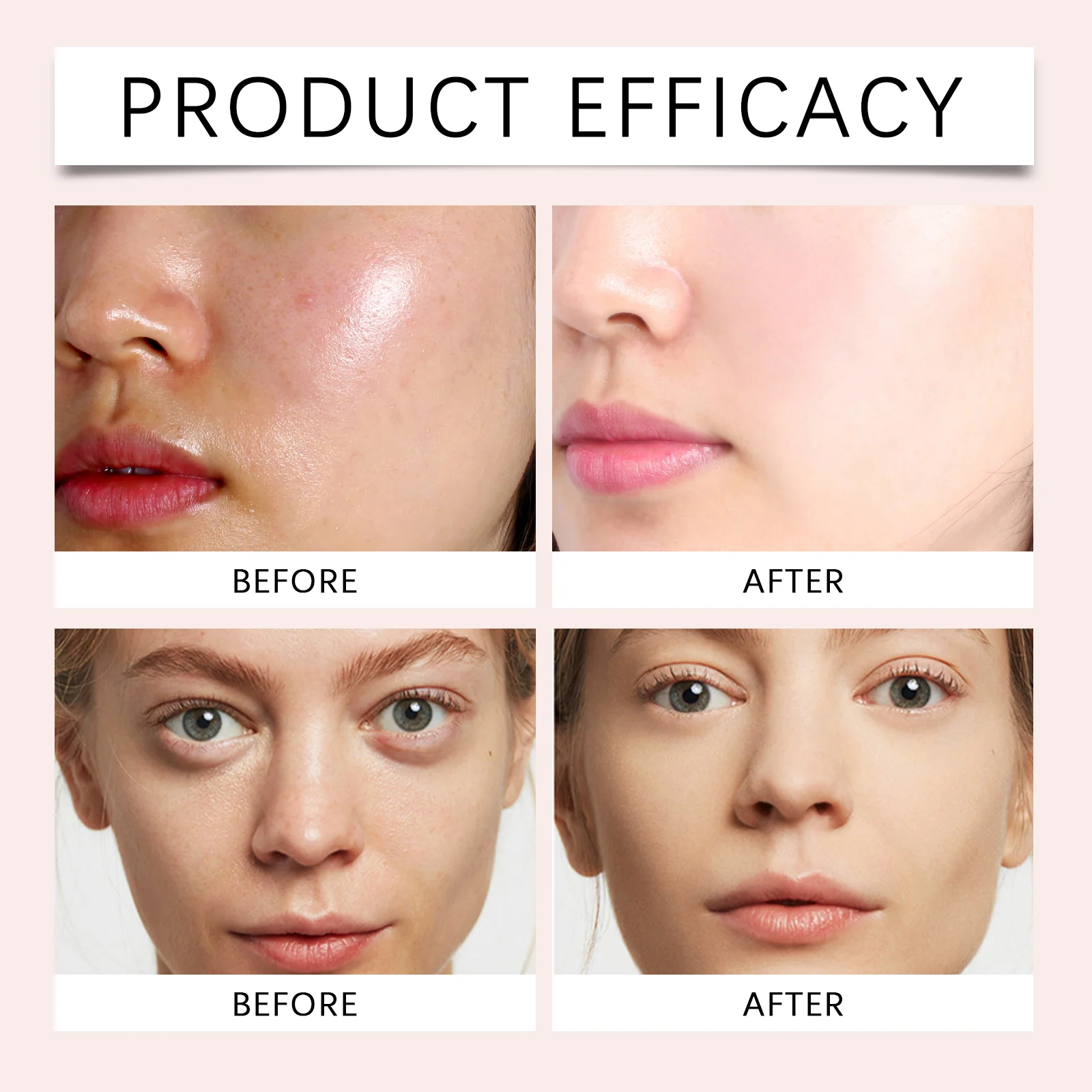 Niacinamide Pore Tightening Serum Hydrating Moisturizing Oil Control Reduce Blackheads 30ml 12 niacinamide pore tightening serum 30ml wes 9g75ydcw desc 12