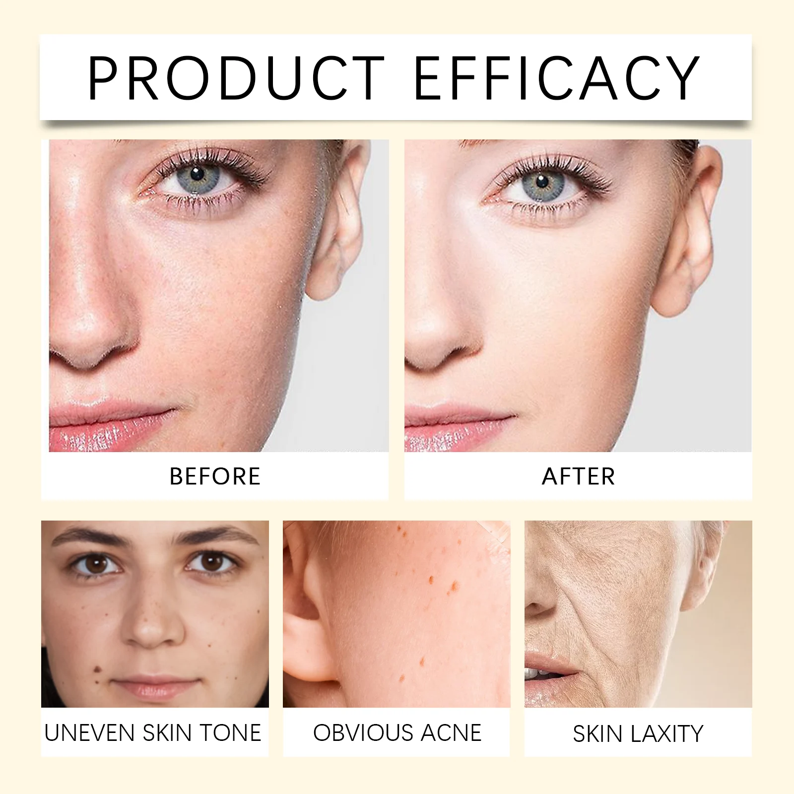 Niacinamide Serum 100ml Hydrating Brightening Facial Skincare for All Skin Types 9 niacinamide serum 100ml hydrating brightening wes vqffkwm6 desc 9