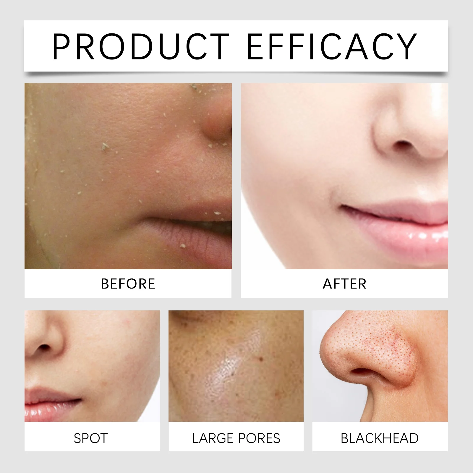 Rice Exfoliating Serum 30ml with Niacinamide & Rice Bran Water for Gentle Pore Refining and Hydration 10 rice exfoliating serum 30ml niacinamide wes 5g53rkgz desc 10