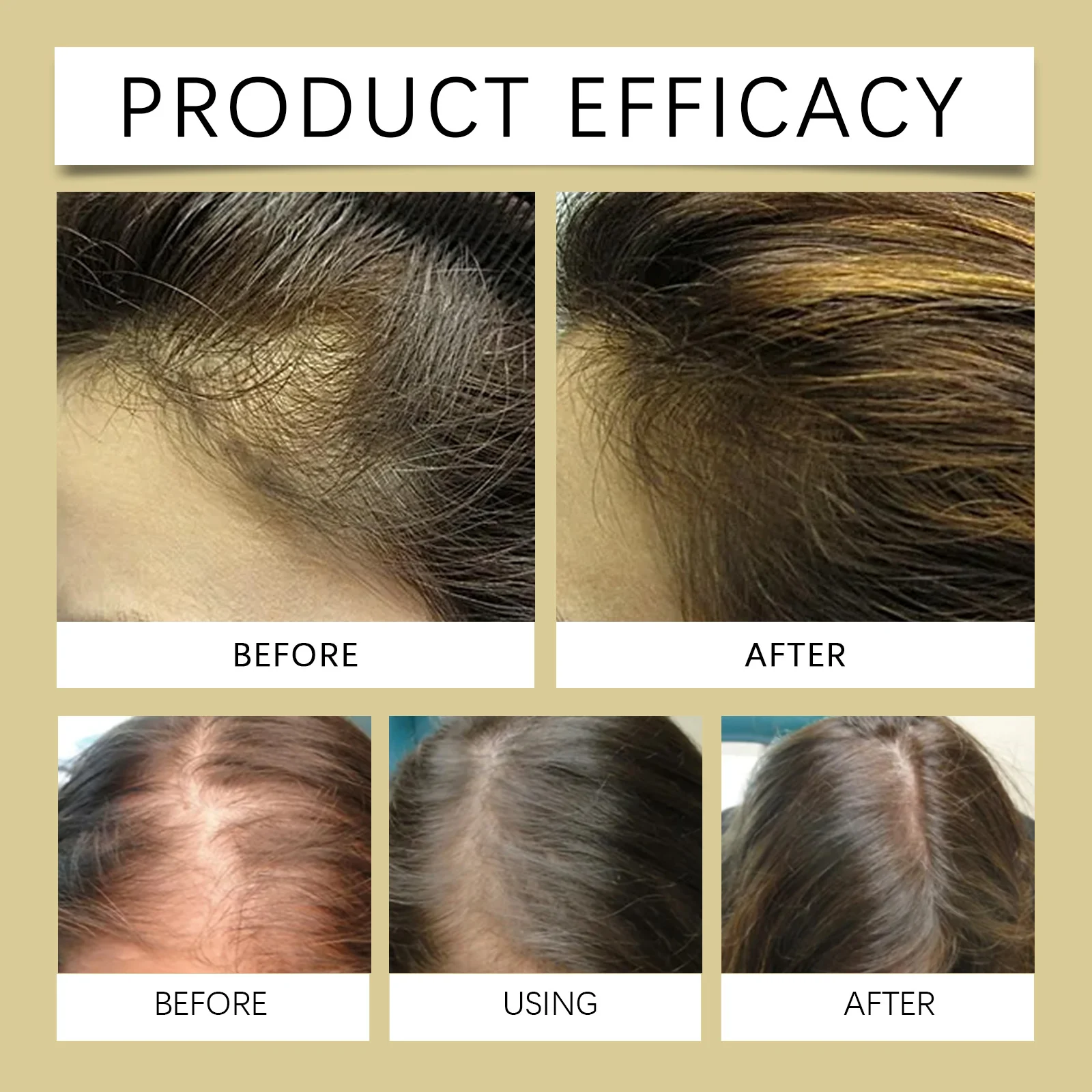 West Month Rosemary Hair Care Oil - Nourish, Strengthen, and Promote Hair Growth 9 rosemary hair care oil wes kd3tyxf6 desc 9