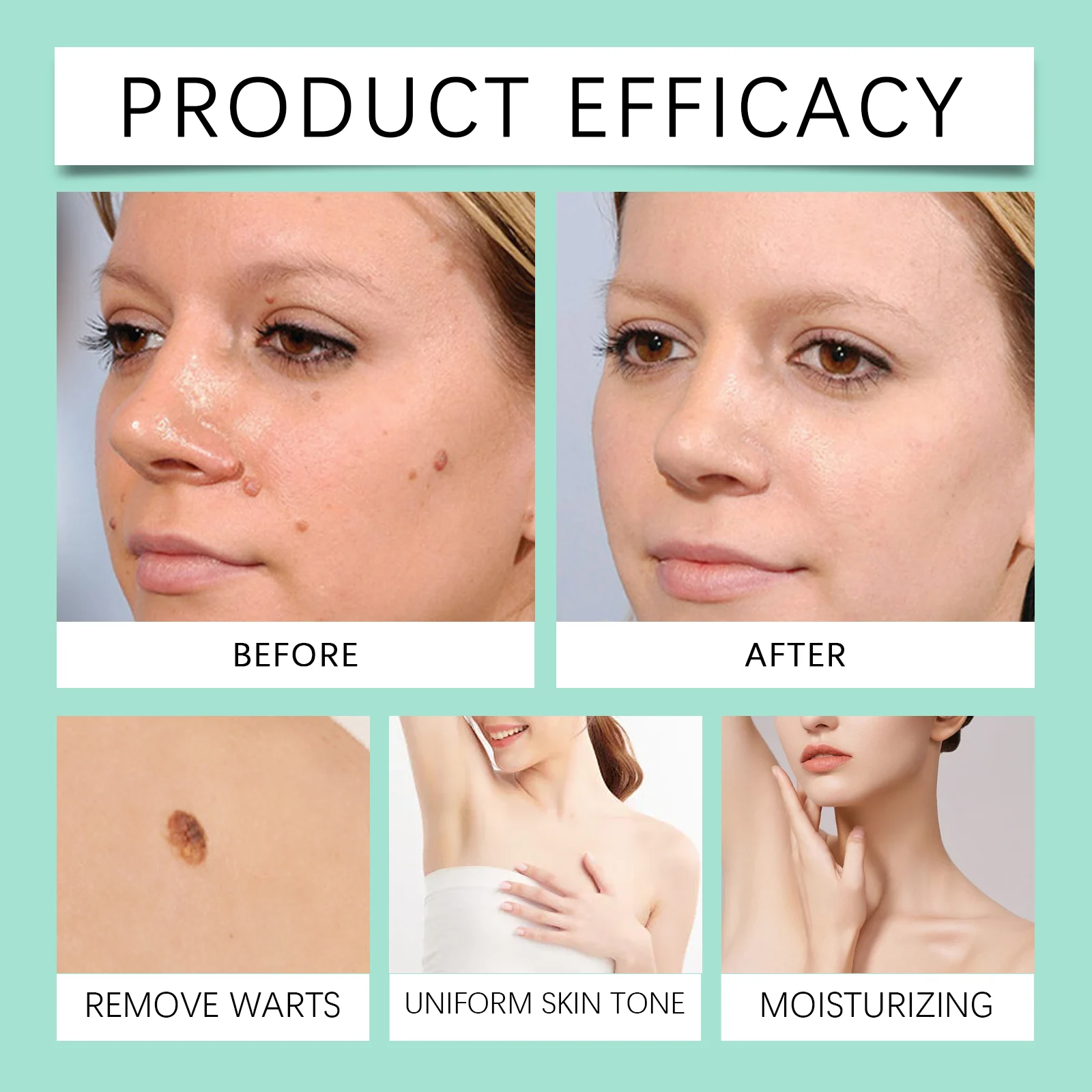 West Month NMN All-Skin Soothing Spray for Acne Repair & Moisturizing 9 skin soothing repair spray wes bf8s9vzw desc 9