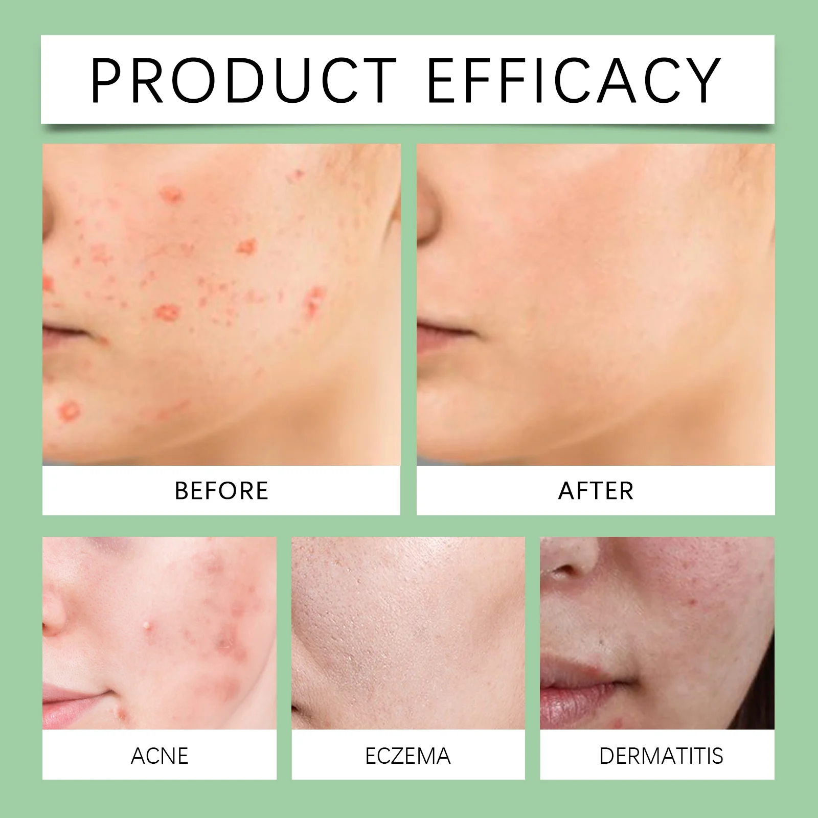 Soothe Soursop Oil 100ml for Deep Moisturizing, Soothing & Skin Radiance 9 soothe soursop oil 100ml wes waxf4eyb desc 9