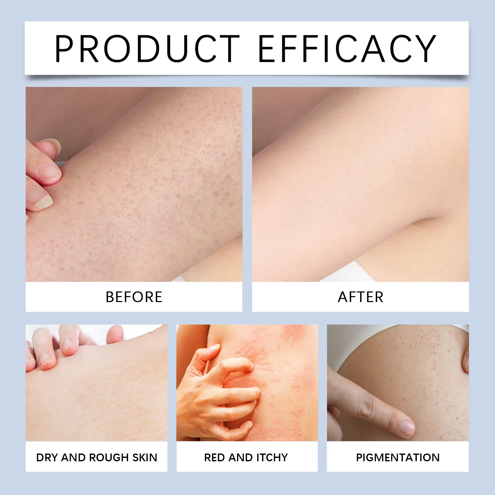 Soothing Repair Body Wash 100g for Dry, Itchy Skin with Vitamin E & Hyaluronic Acid 9 soothing repair body wash 100g wes kavyqcgu desc 9