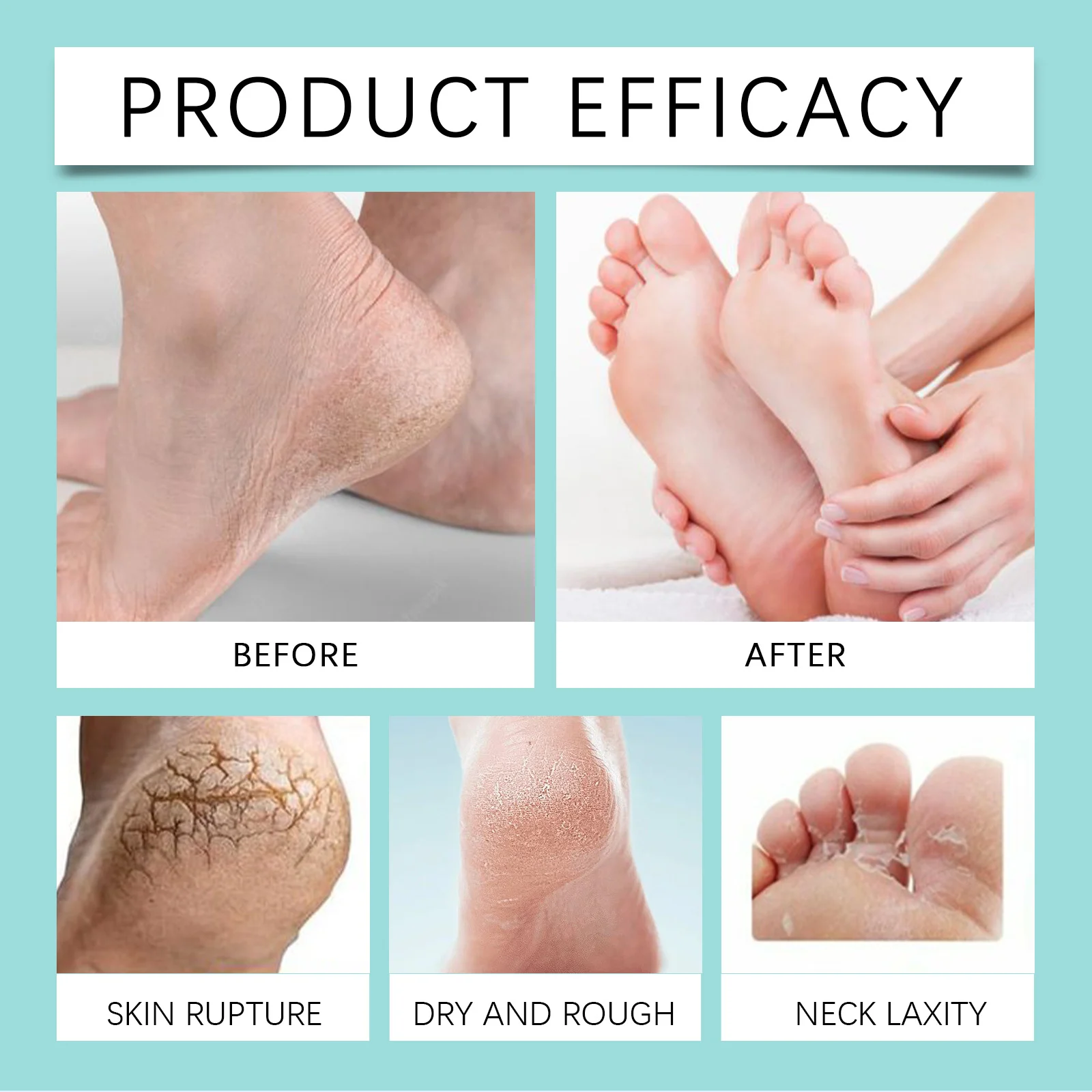 Vitamin Moisturizing Foot Cream 100g for Repairing Dry Cracked Feet 8 vitamin moisturizing foot cream 100g wes 7phzecv7 desc 8
