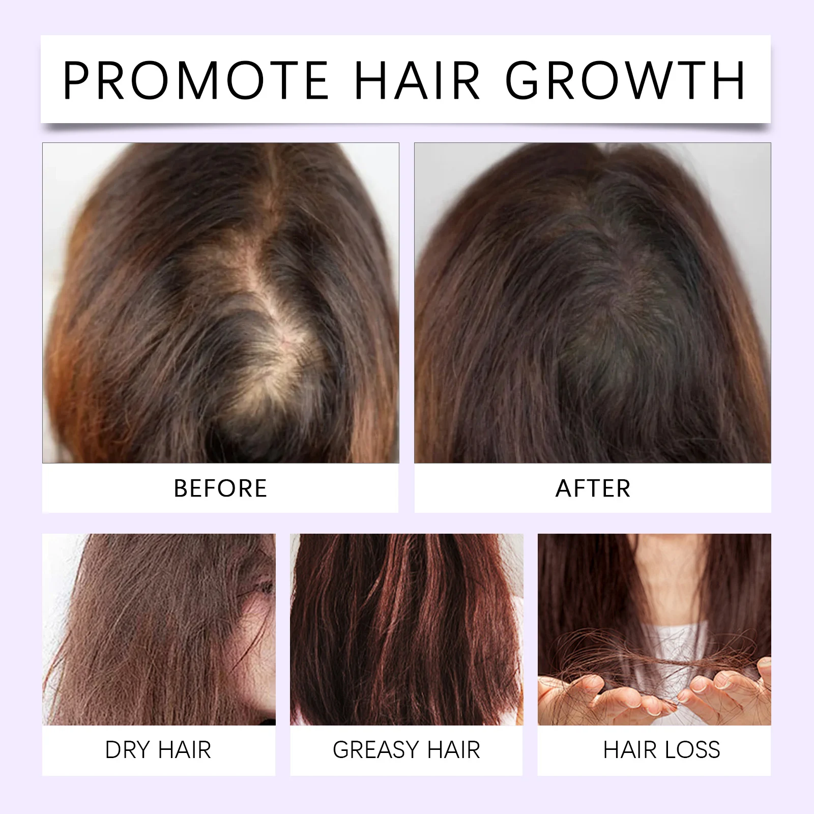 Hair Tonic Scalp Treatment 30ml Herbal Essence for Hair Growth & Nourishment 9 westmonth hair tonic scalp treatment 30ml wes dk5nyxm5 desc 9