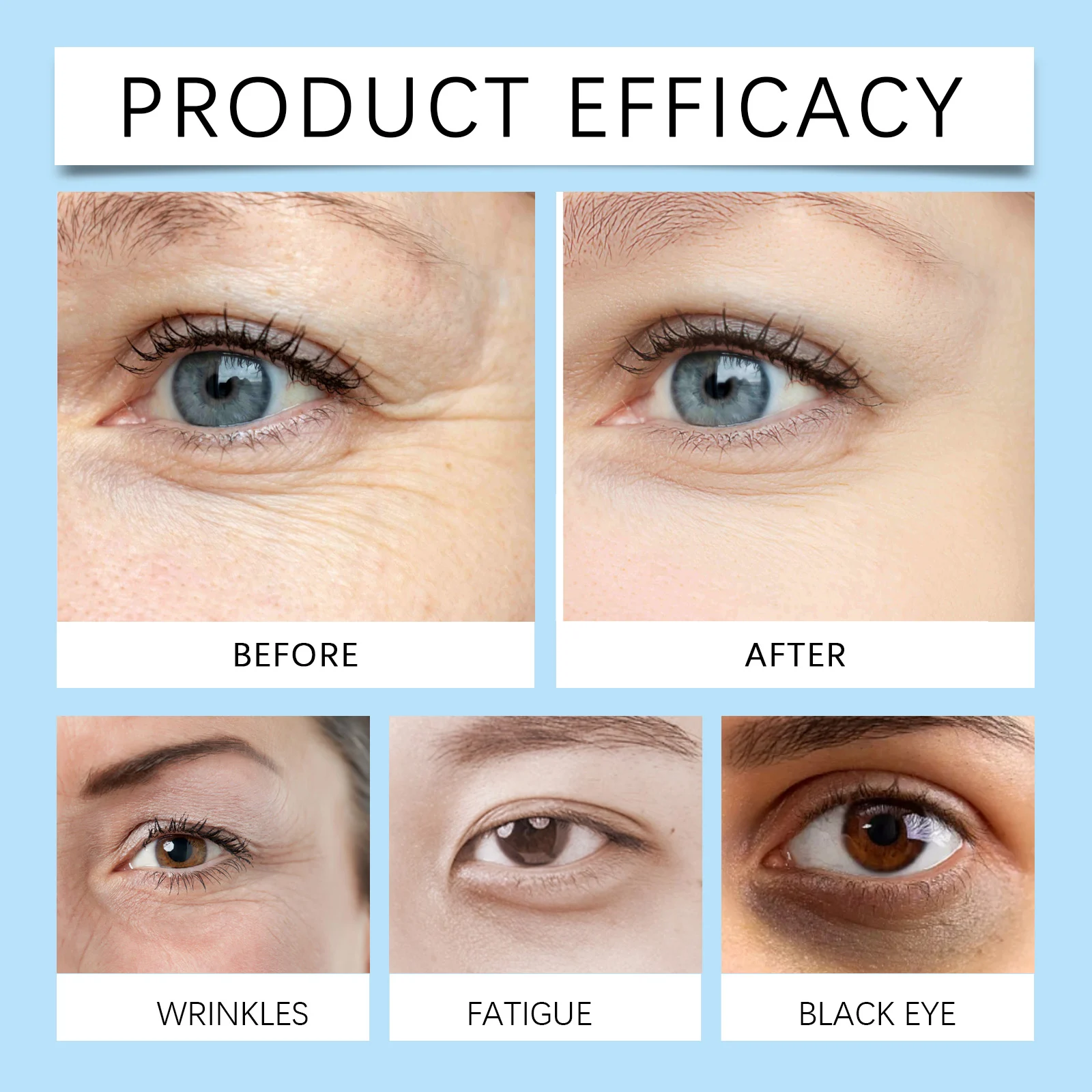 Wrinkle Puffy Eye Power Serum 1ml Anti-Aging Eye Treatment for Dark Circles & Bags 9 wrinkle puffy eye power serum 1ml anti aging eye treatment wes sx729hwf desc 9