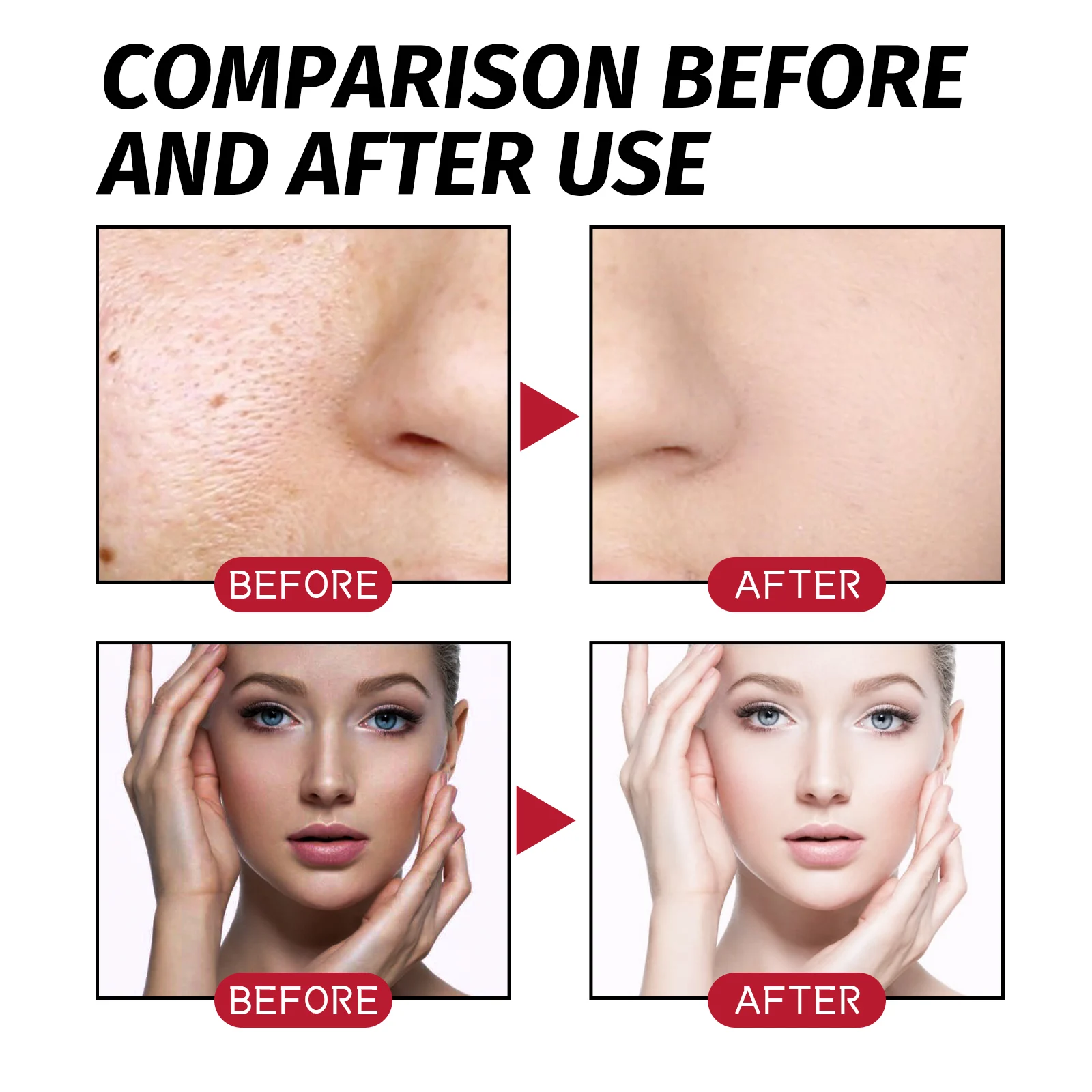 West Month AHA PHA BHA 32% Face Peel Serum for Instant Glow & Soft Skin 9 aha face peel serum wes 79cgzybw desc 9