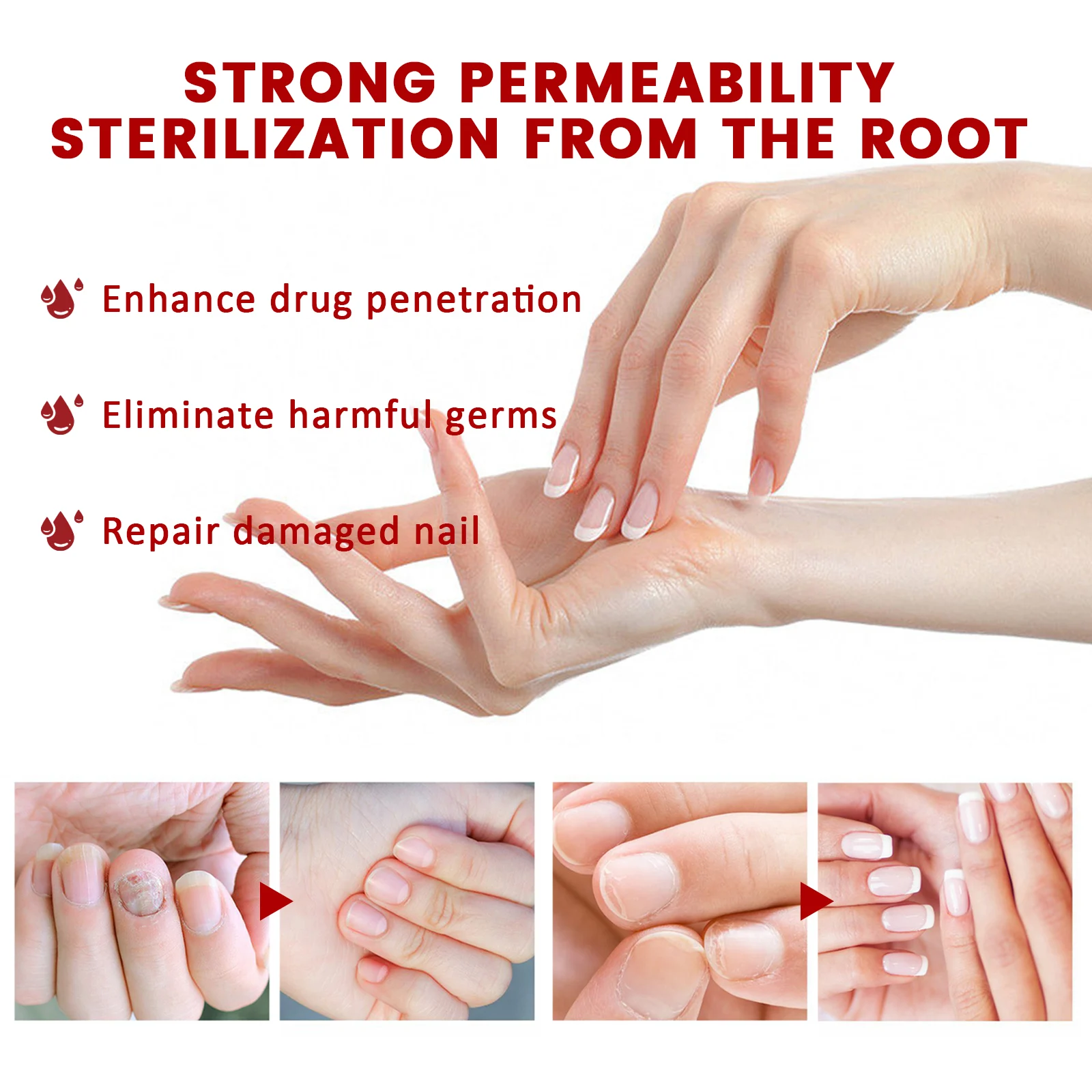 West Month Fungus Relief Oil for Toenails, Soften Thick Nails, Anti-Fungal Treatment, Nail Repair 7 anti fungus nail relief oil wes 5yurc2bj desc 7