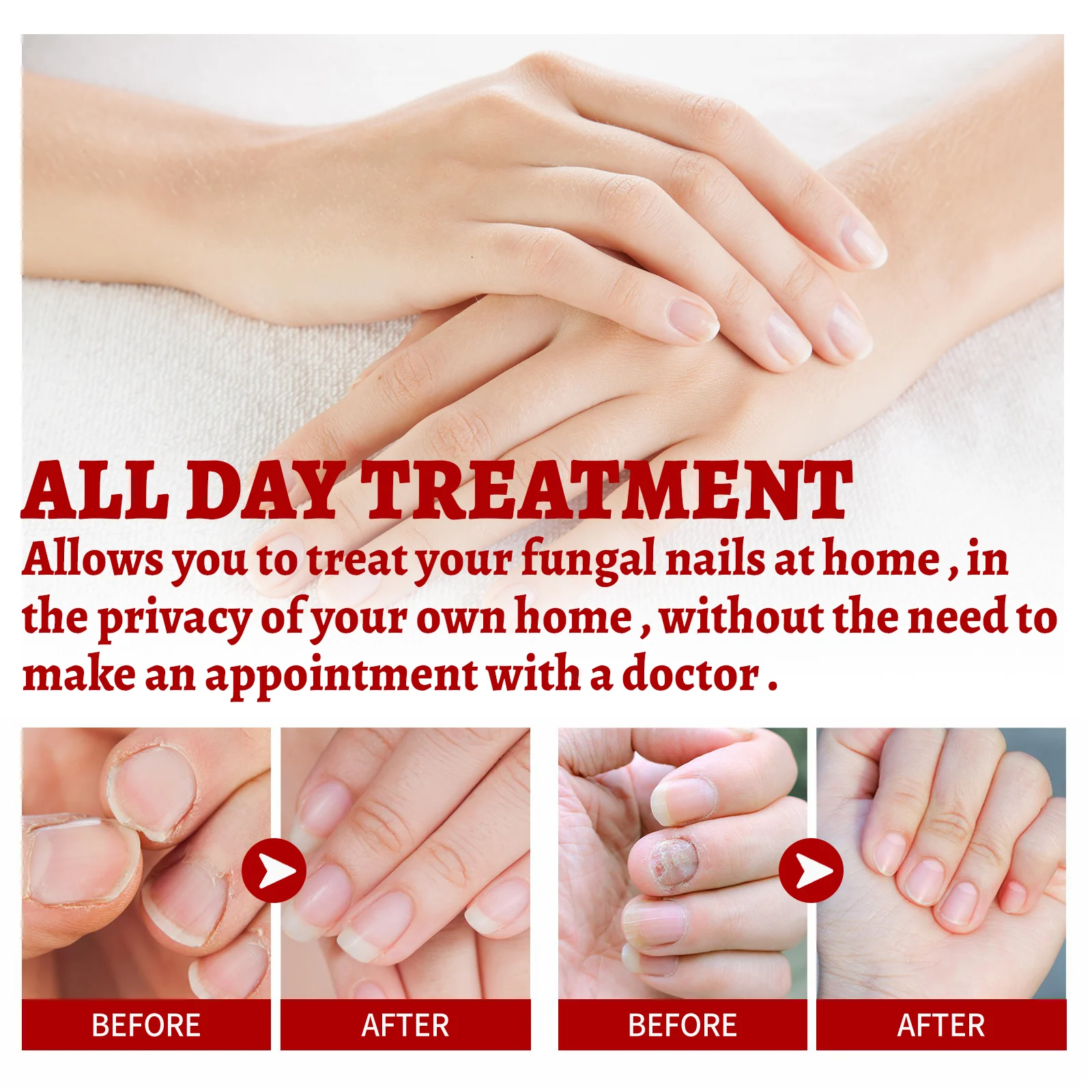 West Month Fungus Relief Oil for Toenails, Soften Thick Nails, Anti-Fungal Treatment, Nail Repair 9 anti fungus nail relief oil wes 5yurc2bj desc 9