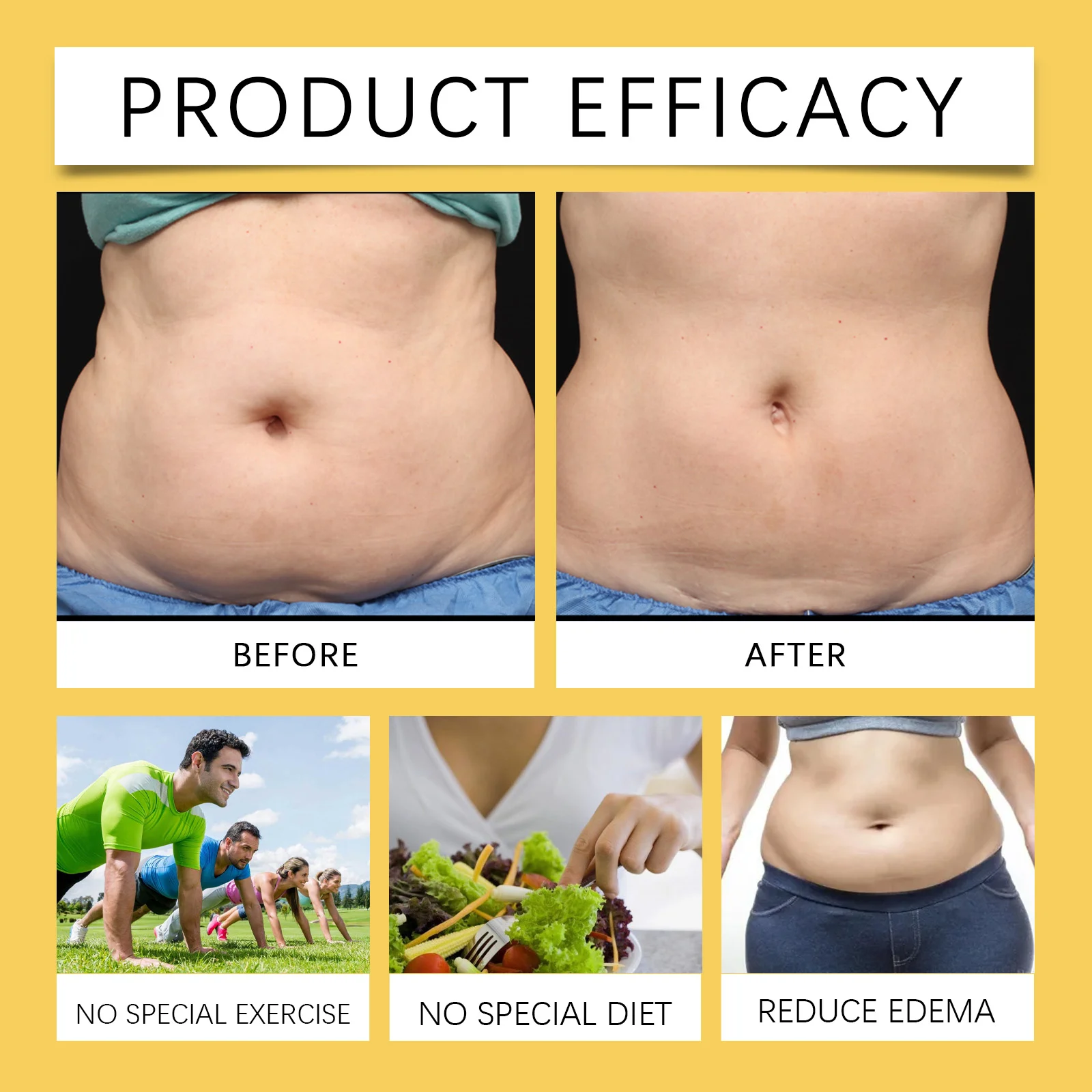 Bee Venom Slimming Patch Abdomen Tummy Tightening Stomach Body Wrap for Belly Fat 10 bee venom slimming patch abdomen tummy tightening stomach body wrap wes jjjh5xm3 desc 10